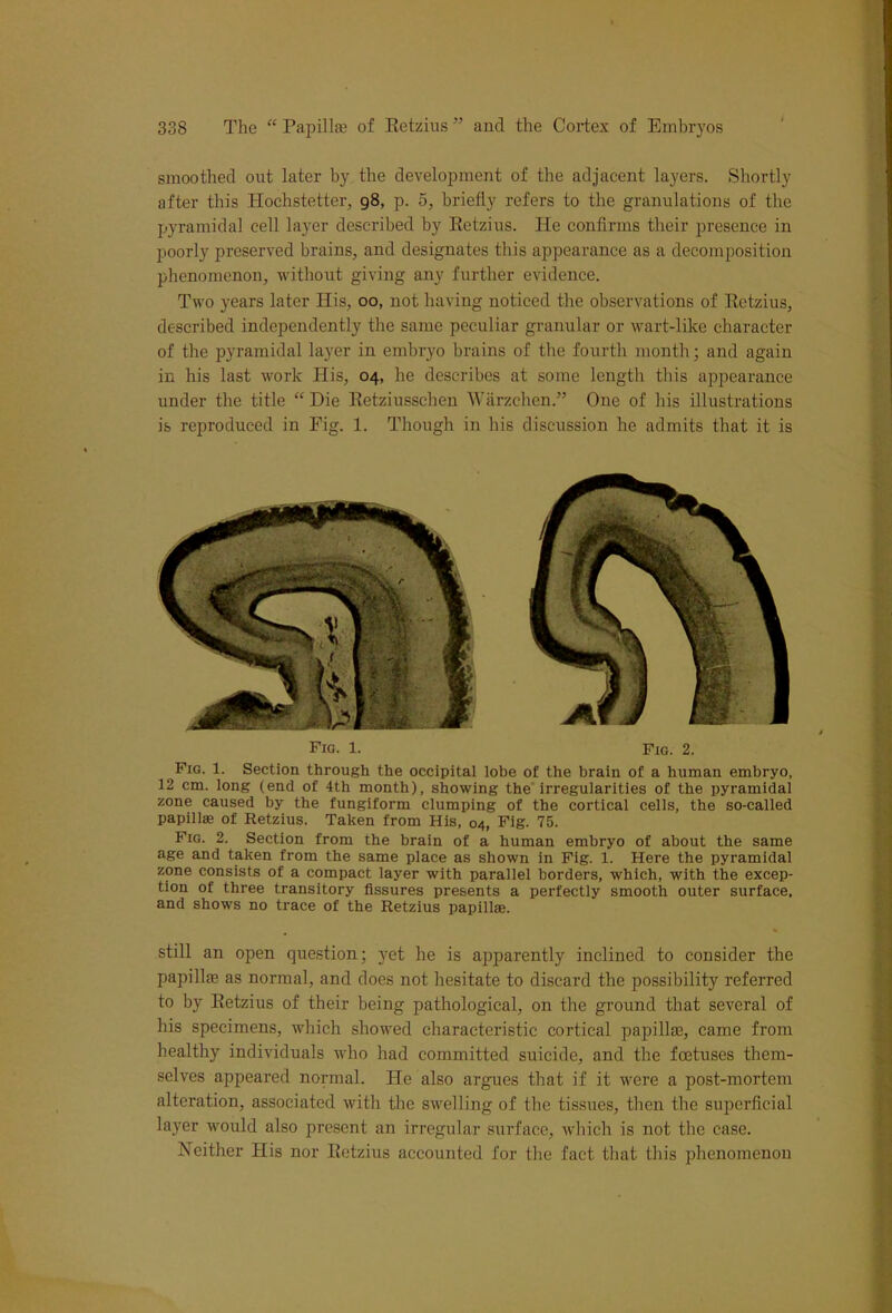 smoothed out later by the development of the adjacent layers. Shortly after this Hochstetter, 98, p. 5, briefly refers to the granulations of the pyramidal cell layer described by Retzius. He confirms their presence in poorly preserved brains, and designates this appearance as a decomposition phenomenon, without giving any further evidence. Two years later His, 00, not having noticed the observations of Retzius, described independently the same peculiar granular or wart-like character of the pyramidal layer in embryo brains of the fourth month; and again in his last work His, 04, he describes at some length this appearance under the title “ Die Retziusschen Warzchen.” One of his illustrations is reproduced in Fig. 1. Though in his discussion he admits that it is Fig. 1. Pio. 2. Fig. 1. Section through the occipital lobe of the brain of a human embryo, 12 cm. long (end of 4th month), showing the irregularities of the pyramidal zone caused by the fungiform clumping of the cortical cells, the so-called papillae of Retzius. Taken from His, 04, Fig. 75. Fig. 2. Section from the brain of a human embryo of about the same age and taken from the same place as shown in Fig. 1. Here the pyramidal zone consists of a compact layer with parallel borders, which, with the excep- tion of three transitory fissures presents a perfectly smooth outer surface, and shows no trace of the Retzius papillae. still an open question; yet he is apparently inclined to consider the papillae as normal, and does not hesitate to discard the possibility referred to by Retzius of their being pathological, on the ground that several of his specimens, which showed characteristic cortical papillae, came from healthy individuals who had committed suicide, and the foetuses them- selves appeared normal. He also argues that if it were a post-mortem alteration, associated with the swelling of the tissues, then the superficial la}rer would also present an irregular surface, which is not the case. Neither His nor Retzius accounted for the fact that this phenomenon