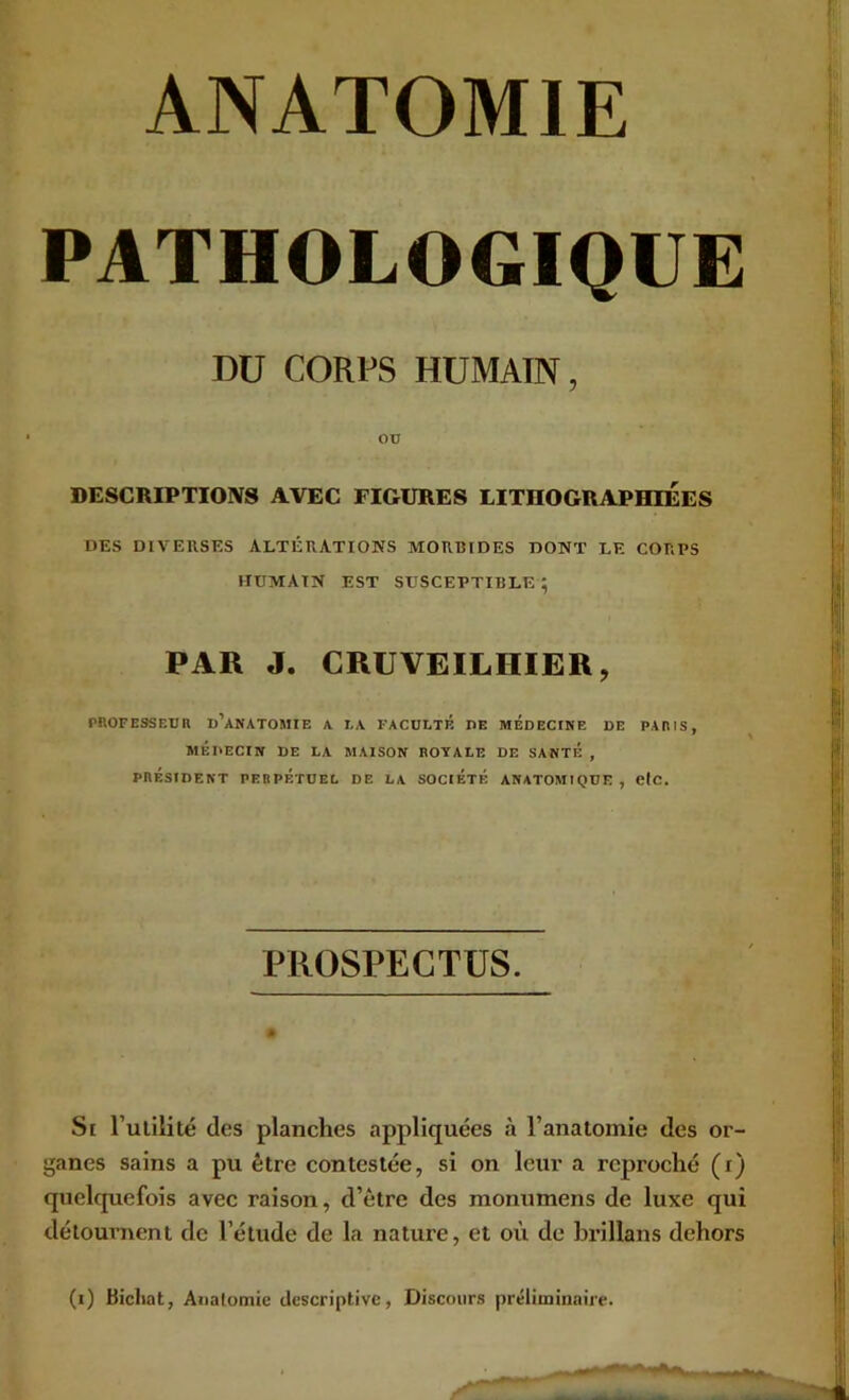 ANATOMIE PATHOLOGIQUE DU CORPS HUMAIN, ou DESCRIPTIOIVS AVEC FIGURES LITHOGRAPHIEES DES DIVERSES ALTÉRATIONS MORBIDES DONT LE CORPS HUMAIN EST SUSCEPTIBLE ; PAR J. CRUVEILHIER, PROFESSEUR d’anatomie A I,A FACULTÉ DE MEDECINE DE PARIS, MÉDECIN DE LA MAISON ROYALE DE SANTE , PRÉSIDENT PERPÉTUEL DE LA SOCIÉTÉ ANATOMIQUE, ClC. PROSPECTUS. Si Fulilité des planches appliquées à l’anatomie des or- ganes sains a pu être contestée, si on leur a reproché (i) quelquefois avec raison, d’être des monumens de luxe qui détournent de l’étude de la nature, et où de hrillans dehors