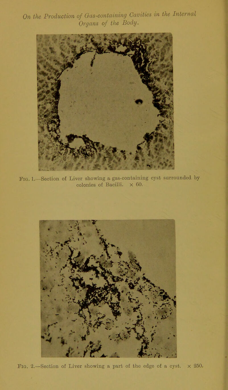 On the Production of Gas-containing Cavities in the Interval Organs of the Body. Fig. L—Section of Liver showing a gas-containing cyst surrounded by colonies of Bacilli. X 60. Fig. 2.—Section of Liver showing a part of the edge of a cyst, x 250.