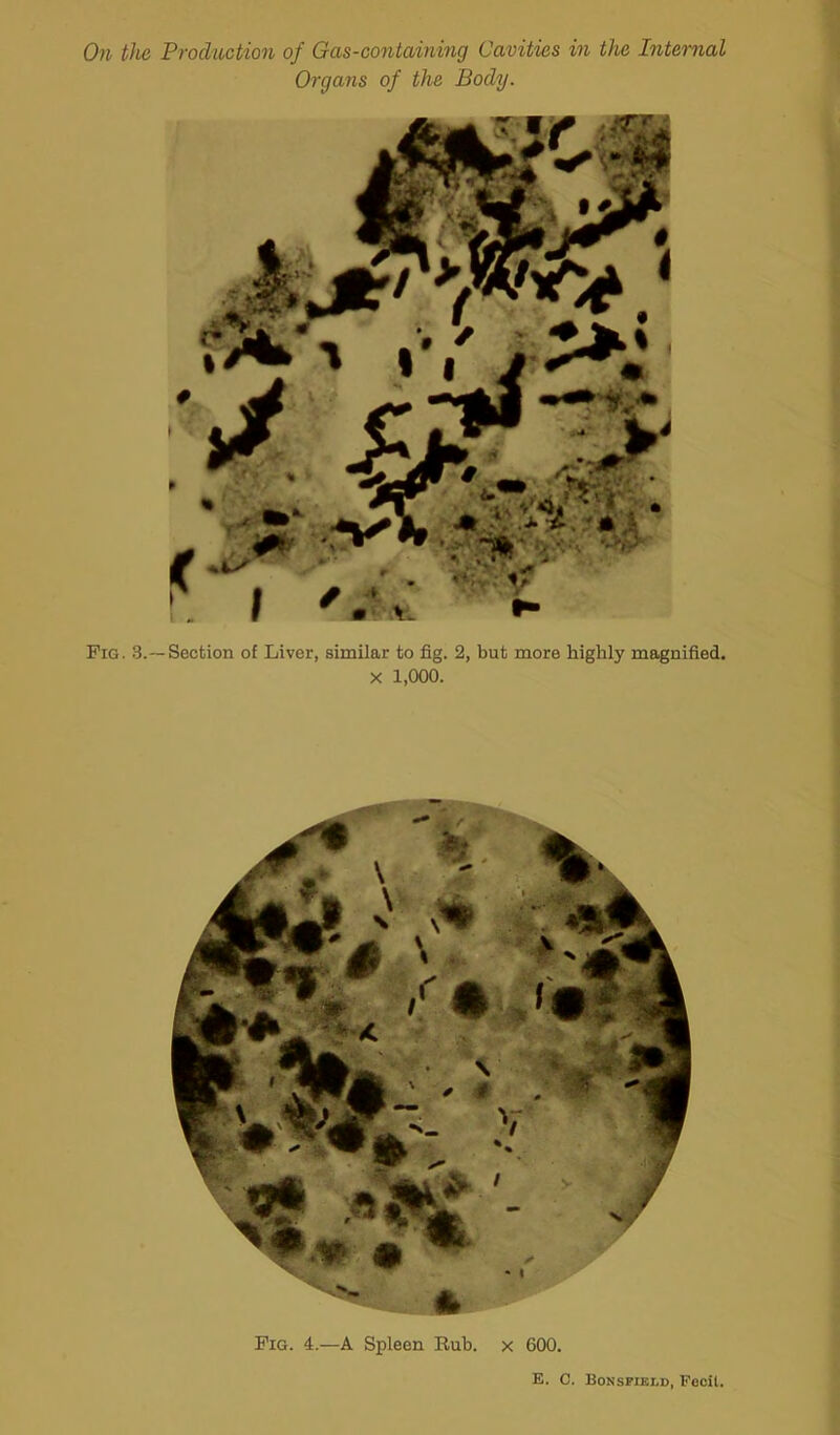 On the Production of Gas-containing Cavities in the Internal Organs of the Body. Fig. 3.— Section of Liver, similar to fig. 2, but more highly magnified. X 1,000. Fig. 4.—A Spleen Rub. x 600. E. C. Bonsfiei.d, Fecit.