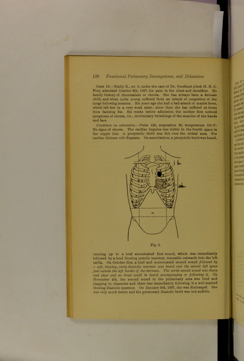 Cask 13.—Emily K., set. 8, under the care of Dr. Goodhart (clerk H. E. C. Fox), admitted October 9th, 1897, for pain in the chest and shoulders. No family history of rheumatism or chorea. She has always been a delicate child, and when quite young suffered from an attack of congestion of the lungs following measles. Six years ago she had a bad attack of scarlet fever, which left her in a very weak state; since then she has suffered at times from fainting fits. Six weeks before admission the mother first noticed symptoms of chorea, viz., involuntary twitohings of the muscles of the hands and face. Ccmditicm on adniissioti.—Pulse 120, respiration 36, temperature 1012°. No signs of chorea. The cardiac impulse was visible in the fourth space in the nipple line. A presystolic thrill was felt over the mitral area. For cardiac dulness vide diagram. On auscultation, a presystolic bruit was heard, running up to a loud accentuated first sound, which was immediately followed by a loud blowing systolic murmur, traceable outwards into the left axilla. On October 21st, a loud and accentuated second sound followed by a soft, blowing, early diastolic murmur was heard over the second left space Just outside the left border of the sternum. The aortic second sound was sharp and clear and no br-uit could be heard accompanying or following it. On November 4th, the second sound in the pulmonary area was loud and slapping in character and there was immediately following it a well-marked blowing diastolic murmur. On January 3rd, 1897, she was discharged. She was verjf much better and the pulmonary diastolic bruit was not audibly,