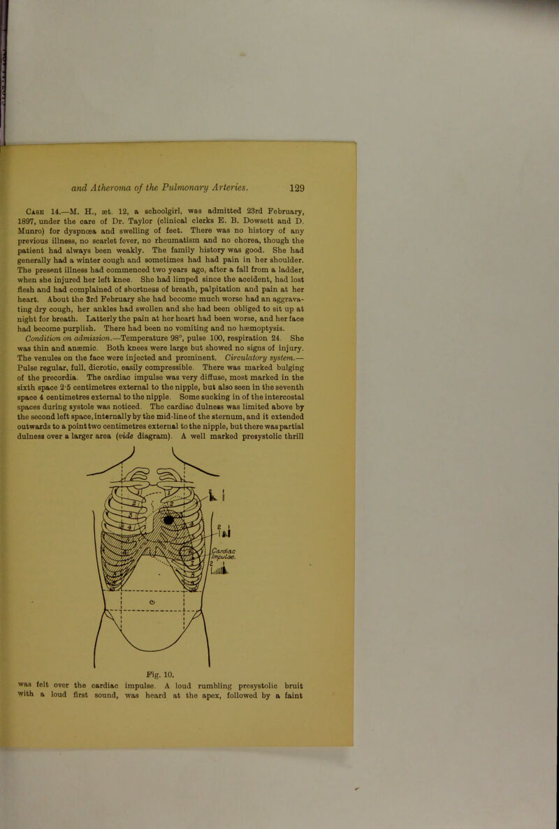 Case 14.—M. H., set. 12, a schoolgirl, was admitted 23rd February, 1897, under the care of Dr. Taylor (clinical clerks E. B. Dowsett and D. Munro) for dyspnoea and swelling of feet. There was no history of any previous illness, no scarlet fever, no rheumatism and no chorea, though the patient had always been weakly. The family history was good. She had generally had a winter cough and sometimes had had pain in her shoulder. The present illness had commenced two years ago, after a fall from a ladder, when she injured her left knee. She had limped since the accident, had lost flesh and had complained of shortness of breath, palpitation and pain at her heart. About the 3rd February she had become much worse had an aggrava- ting dry cough, her ankles had swollen and she had been obliged to sit up at night for breath. Latterly the pain at her heart had been worse, and her face had become purplish. There had been no vomiting and no haemoptysis. Cotidition on admission.—Temperature 98°, pulse 100, respiration 24. She was thin and anaemic. Both knees were large but showed no signs of injury. The venules on the face were injected and prominent. Circulatory system.— Pulse regular, full, dicrotic, easily compressible. There was marked bulging of the precordia. The cardiac impulse was very diffuse, most marked in the sixth space 2-5 centimetres external to the nipple, but also seen in the seventh space 4 centimetres external to the nipple. Some sucking in of the intercostal spaces during systole was noticed. The cardiac dulness was limited above by the second left space, internally by the mid-line of the sternum, and it extended outwards to a point two centimetres external to the nipple, but there was partial dulness over a larger area {inde diagram). A well marked presystolic thrill Fig. 10. was felt over the cardiac impulse. A loud rumbling presystolic bruit \yith a loud first sound, was heard at the apex, followed by a faint