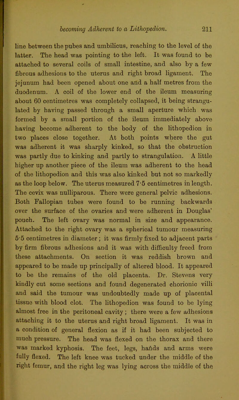 line between the pubes and umbilicus, reaching to the level of the latter. The head was pointing to the left. It was found to be attached to several coils of small intestine, and also by a few fibrous adhesions to the uterus and right broad ligament. The jejunum had been opened about one and a half metres from the duodenum. A coil of the lower end of the ileum measuring about 60 centimetres was completely collapsed, it being strangu- lated by having passed through a small aperture which was formed by a small portion of the ileum immediately above having become adherent to the body of the lithopedion in two places close together. At both points where the gut was adherent it was sharply kinked, so that the obstruction was partly due to kinking and partly to strangulation. A little higher up another piece of the ileum was adherent to the head of the lithopedion and this was also kinked but not so markedly as the loop below. The uterus measured 7*5 centimetres in length. The cevix was nulliparous. There were general pelvic adhesions. Both Fallopian tubes were found to be running backwards over the surface of the ovaries and were adherent in Douglas’ pouch. The left ovary was normal in size and appearance. Attached to the right ovary was a spherical tumour measuring 55 centimetres in diameter; it was firmly fixed to adjacent parts by firm fibrous adhesions and it was with diflBculty freed from these attachments. On section it was reddish brown and appeared to be made up principally of altered blood. It appeared to be the remains of the old placenta. Dr. Stevens very kindly cut some sections and found degenerated chorionic villi and said the tumour was undoubtedly made up of placental tissue with blood clot. The lithopedion was found to be lying almost free in the peritoneal cavity ; there were a few adhesions attaching it to the uterus and right broad ligament. It was in a condition of general flexion as if it had been subjected to much pressure. The head was flexed on the thorax and there was marked kyphosis. The feet, legs, hands and arms were fully flexed. The left knee was tucked under the middle of the right femur, and the right leg was lying across the middle of the