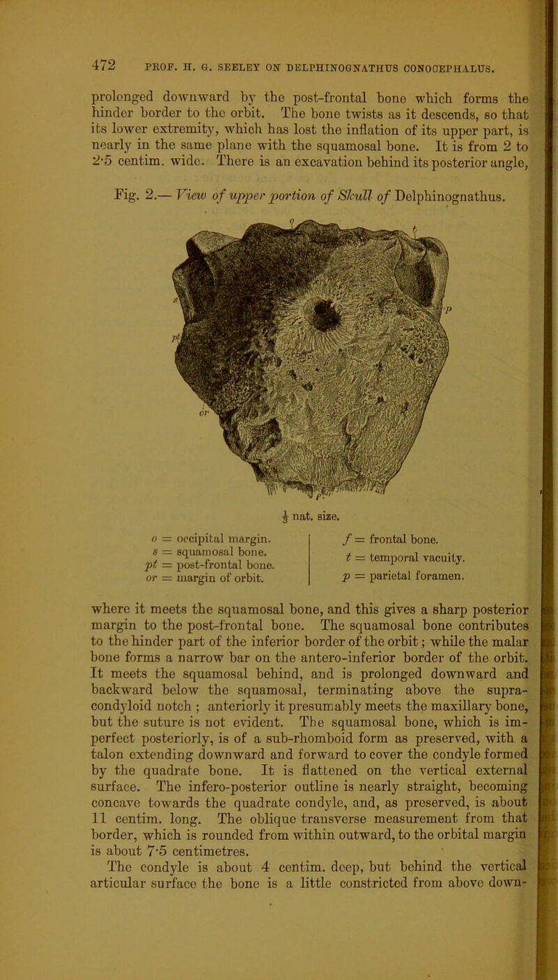 prolonged downward by the post-frontal bone which forms the hinder border to the orbit. The bone twists as it descends, so that its lower extremity, which has lost the inflation of its upper part, is nearly in the same plane with the squamosal bone. It is from 2 to 2-5 centim. wide. There is an excavation behind its posterior angle, Fig. 2.— View of upper portion of Skull of Delphinognathus. 5 nat. size. o = occipital margin. s = squamosal bone. ft = post-frontal bone. or — margin of orbit. / - frontal bone. t — temporal vacuity. p — parietal foramen. where it meets the squamosal bone, and this gives a sharp posterior margin to the post-frontal bone. The squamosal bone contributes to the hinder part of the inferior border of the orbit; while the malar bone forms a narrow bar on the antero-inferior border of the orbit. It meets the squamosal behind, and is prolonged downward and backward below the squamosal, terminating above the supra- condyloid notch ; anteriorly it presumably meets the maxillary bone, but the suture is not evident. The squamosal bone, which is im- perfect posteriorly, is of a sub-rhomboid form as preserved, with a talon extending downward and forward to cover the condyle formed by the quadrate bone. It is flattened on the vertical external surface. The infero-posterior outline is nearly straight, becoming concave towards the quadrate condyle, and, as preserved, is about 11 centim. long. The oblique transverse measurement from that | border, which is rounded from within outward, to the orbital margin is about 7’5 centimetres. The condyle is about 4 centim. deep, but behind the vertical I articular surface the bone is a little constricted from above down- (