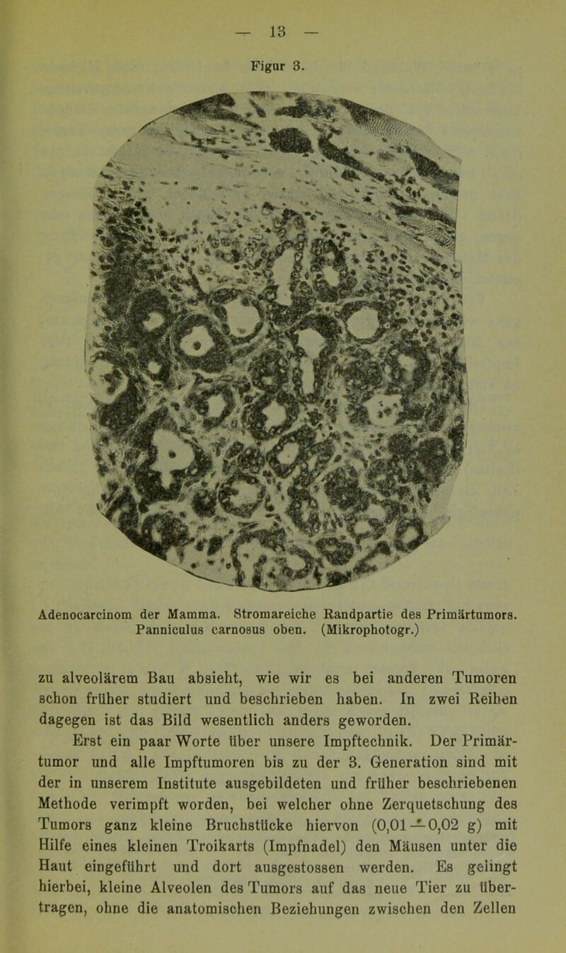 Figur 3. Adenocarcinom der Mamma. Stromareiche Randpartie des Primärtumors. Panniculus carnosus oben. (Mikrophotogr.) zu alveolärem Bau absieht, wie wir es bei anderen Tumoren schon früher studiert und beschrieben haben. In zwei Reihen dagegen ist das Bild wesentlich anders geworden. Erst ein paar Worte Uber unsere Impftechnik. Der Primär- tumor und alle Impftumoren bis zu der 3. Generation sind mit der in unserem Institute ausgebildeten und früher beschriebenen Methode verimpft worden, bei welcher ohne Zerquetschung des Tumors ganz kleine Bruchstücke hiervon (0,01 — 0,02 g) mit Hilfe eines kleinen Troikarts (Impfnadel) den Mäusen unter die Haut eingefUhrt und dort ausgestossen werden. Es gelingt hierbei, kleine Alveolen des Tumors auf das neue Tier zu über- tragen, ohne die anatomischen Beziehungen zwischen den Zellen