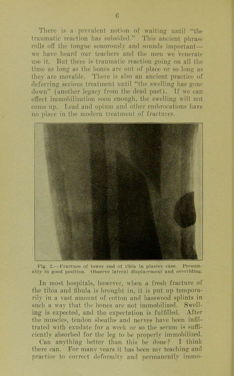 G 'I'liere is a |)r('valcnt iiolioii ol' waitin^^ until ‘‘the traumatic ivactioii has suhsidc'd.” d’his ancient plirasc rolls oir the tongue sonorously and sounds important— wo have heard our teachers and the men we venerate use it. lUit thei’e is trailmatie reaction going on all the time as long as the hones are out of place or so long as they are movahle. ddiere is also an ancient practice of defenving serious treatment until “the swelling has gone down” (another legacy from the dead past). If we can effect immohilization soon enough, the swelling will not come up. Lead aud opium and other embrocations have no place in the modei’u treatment of fractures. Fig. 2.—Fractiu'e of lower end of tibia in plaster case. Fresunv ably in good position. Observe lateral dis|)lacement and overriding. In most hospitals, however, when a fresh fracture of the tibia and fibula is brought in, it is put up tempora- rily in a vast amount of cotton and basswood splints in such a way that the bones are not immobili/^ed. Swell- ing is expected, and the expectation is fulfilled. After the muscles, tendon sheaths and nerves have been infil- trated with exudate for a week or so the scrum suffi- ciently absorbed for the leg to be properly immobilized. Can anything better than this be done? 1 think there can. For manv years it has been my teaching and practice to con*ect deformity and permanently immo-