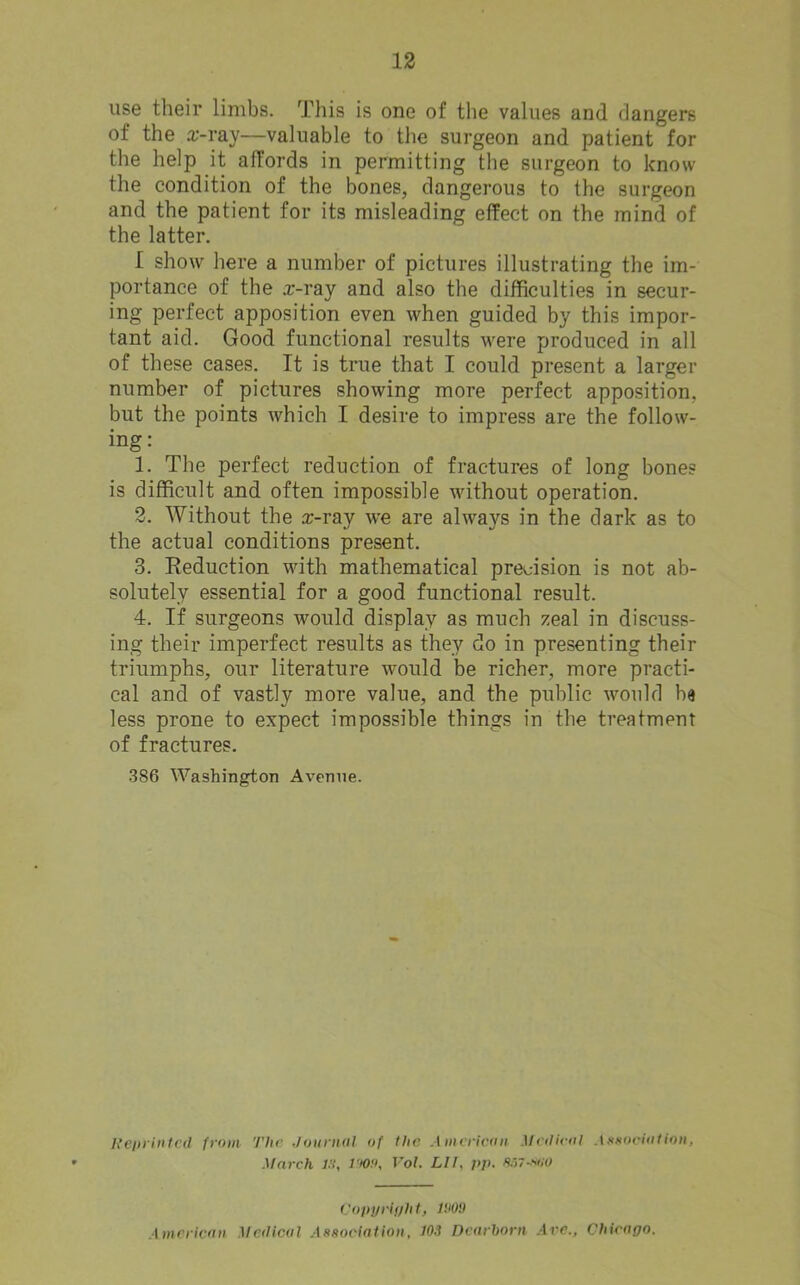 use their limbs. This is one of the values and dangers of the rr-ray—valuable to the surgeon and patient for the help it affords in permitting the surgeon to know the condition of the bones, dangerous to the surgeon and the patient for its misleading effect on the mind of the latter, I show here a number of pictures illustrating the im- portance of the :r-ray and also the difficulties in secur- ing perfect apposition even when guided by this impor- tant aid. Good functional results were produced in all of these cases. It is true that I could present a larger number of pictures showing more perfect apposition, but the points which I desire to impress are the follow- ing: 1. The perfect reduction of fractures of long bones is difficult and often impossible without operation. 2. Without the a:-ray we are always in the dark as to the actual conditions present. 3. Seduction with mathematical pre<jision is not ab- solutely essential for a good functional result. 4. If surgeons would display as much zeal in discuss- ing their imperfect results as they do in presenting their triumphs, our literature would be richer, more practi- cal and of vastly more value, and the public would be less prone to expect impossible things in the treatment of fractures. .386 Washington Avenue. h’einintcd from The Journol of the A meiiroii Mnlirol Axsociiitioii, March j:i, Vol. LI I, jip. s/iy-xno Vopi/rinht, li'Oi) American Medical Asxociation, 103 Dearhorn .4rc., Chicago.