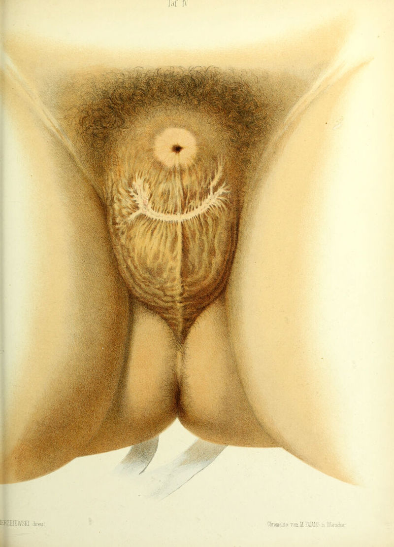 Jcit IV