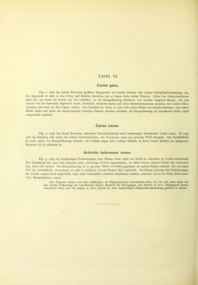 Caries genu. Fig. i. stellt das behufs Resection geöffnete Kniegelenk bei Gonitis ulcerosa und eitriger Kniegelenksentzündung dar. Die Synovialis ist trüb, in den Falten und Buchten derselben (bei e) liegen dicke eitrige Flocken. Ueber den Oberschenkelcon- dylen (f), mit denen die Patella (p) fest verlöthet, ist der Knorpelüberzug theilweise von weichen fungösen Massen, die sich schwer von der Synovialis abgrenzen lassen, überdeckt, weiterhin finden sich dicke Granulationsmassen zwischen den beiden Tibia- condylen und vorn an den Ligam. cruciat. Am Condylus int. tibiae ist eine tiefe cariöse Höhle mit scharfen Rändern, eine tiefere Höhle findet sich innen am entsprechenden Condylus femoris, woselbst ebenfalls der Knorpelüberzug an betreffender Stelle scharf ausgezwickt erscheint. Caries coxae. Fig. 2. zeigt den durch Resection entfernten Oberschenkelkopf nach langwieriger (osteogener) Caries coxae. Es zeigt sich der Knochen sehr weich mit dünner Corticalsubstanz, der Trochanter noch zum grössten Theil knorplig. Die Gelenkfläche (c) rauh, cariös, des Knorpelüberzugs beraubt, am Collum zeigen sich 2 kleine Höhlen, in deren Grund deutlich ein gelbgrauer Sequester (s) zu erkennen ist. Arthritis deformans coxae. Fig. 3. zeigt die hochgradigen Veränderungen eines Malum coxae senile sin. (wohl im Anschluss an Coxitis entstanden). Der Gelenkkopf hat eine total abnorme mehr rollenartige Gestalt angenommen, an deren breiter, unterer Fläche das verbreitete Lig. teres sich inserirt. Der Knorpelüberzug ist zu grossem Theile zu Verlust gegangen, an andern Stellen zerfasert, wie ein feiner Pelz die Gelenkfläche überziehend (z) oder in dichteren weissen Plaques (hl.) angehäuft. Die Pfanne erscheint den Veränderungen des Kopfes entsprechend umgebildet, zeigt einen beträchtlich erhöhten knöchernen Limbus, während sich in der Tiefe dichte rund- liche Knorpelplaques zeigen. Das Präparat kommt von einer 60jährigen, an Magencarcinom verstorbenen Frau, bei der sich intra vitam nur eine leichte Verkürzung des betreffenden Beines, Knarren bei Bewegungen und Narben in der 1. Hüftgegend hatten constatiren lassen und die angab, in ihrer Jugend an einer langwierigen Hüftgelenksentzündung gelitten zu haben.