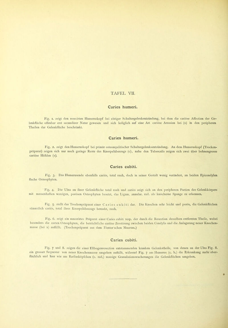 Caries humeri. Fig. I. zeigt den resecirten Humeruskopf bei eitriger Schultergelenkentzündung, bei dem die cariöse Affection der Ge- lenkfläche offenbar erst secundärer Natur gewesen und sich lediglich auf eine Art cariöse Arrosion bei (x) in den peripheren Theilen der Gelenkfläche beschränkt. Caries humeri. Fig. 2. zeigt den Humeruskopf bei primär osteomyelitischer Schultergelenksentzündung. An dem Humeruskopf (Trocken- präparat) zeigen sich nur noch geringe Reste des Knorpelüberzugs (c), nahe den Tuberculis zeigen sich zwei über bohnengrosse cariöse Höhlen (x). Caries cubiti. Fig. 3. Das Humerusende ebenfalls cariös, total rauh, doch in seiner Gestalt wenig verändert, an beiden Epicondylen flache Osteophyten. Fig. 4. Die Ulna an ihrer Gelenkfläche total rauh und cariös zeigt sich an den peripheren Partien des Gelenkkörpers mit massenhaften warzigen, porösen Osteophyten besetzt, das Ligam. annular. rad. als knöcherne Spange zu erkennen. Fig. 5. stellt das Trockenpräparat einer Caries cubiti dar. Die Knochen sehr leicht und porös, die Gelenkflächen sämmtlich cariös, total ihres Knorpelüberzugs beraubt, rauh. Fig. 6. zeigt ein macerirtes Präparat einer Caries cubiti resp. der durch die Resection desselben entfernten Theile, wobei besonders die zarten Osteophyten, die beträchtliche cariöse Zerstörung zwischen beiden Condylis und die Anlagerung neuer Knochen- masse (bei x) auffällt. (Trockenpräparat aus dem Hunterschen Museum.) Caries cubiti. Fig. 7 und 8. zeigen die einer Ellbogenresection entstammenden kranken Gelenkstheile, von denen an der Ulna Fig. 8. ein grosser Sequester von neuer Knochenmasse umgeben auftällt, während Fig. 7 am Humerus (c. h.) die Erkrankung mehr ober- flächlich und hier wie am Radiusköpfchen (c. rad.) massige Granulationswucherungen die Gelenkflächen umgeben. »