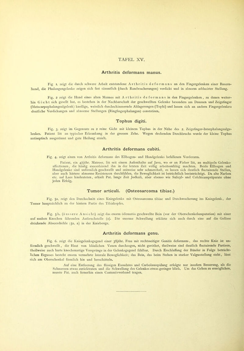 Arthritis deformans manus. Fig I. zeigt die durch schwere Arbeit entstandene Arthritis deformans an den Fingergelenken einer Bauern- hand, die Phalangengelenke zeigen sich fast sämmtlich (durch Randwucherungen) verdickt und in abnorm adducirter Stellung. Fig. 2 zeigt die Hand eines alten Mannes mit Arthritis deformans in den Fingergelenken, zu denen weiter- hin Gicht sich gesellt hat, es bestehen in der Nachbarschaft der geschwellten Gelenke besonders am Daumen und Zeigefinger (Metacarpophalangealgelenk) knollige, weisslich durchschimmernde Ablagerungen (Tophi) und lassen sich an andern Fingergelenken deutliche Verdickungen und abnorme Stellungen (Ringfingerphalangen) constatiren. Tophus digiti. Fig. 3. zeigt im Gegensatz zu 2 reine Gicht mit kleinem Tophus in der Nähe des 2. Zeigefinger-Interphalangealge- lenkes. Patient litt an typischer Erkrankung in der grossen Zehe. Wegen drohenden Durchbruchs wurde der kleine Tophus antiseptisch ausgeräumt und gute Heilung erzielt. Arthritis deformans cubiti. Fig. 4. zeigt einen von Arthritis deformans des Ellbogen- und Handgelenks befallenen Vorderarm. Patient, ein 47jähr. Matrose, litt seit einem Aufenthalte auf Java, wo er an Fieber litt, an multipeln Gelenks- affectionen, die häufig exacerbirend ihn in der letzten Zeit völlig arbeitsunfähig machten. Beide Ellbogen und Handgelenke sind unförmlich geschwellt und zeitweise sehr schmerzhaft, es lassen sich deutlich fluctuirende Stellen, aber auch härtere abnorme Resistenzen durchfühlen, die Beweglichkeit ist beträchtlich beeinträchtigt. Da alte Narben etc. auf Lues hindeuteten, erhielt Pat. lange Zeit Jodkali, aber ebenso wie Salicyl- und Colchicumpräparate ohne jeden Erfolg. Tumor articuli. (Osteosarcoma tibiae.) Fig. 5a. zeigt den Durchschnitt eines Kniegelenks mit Osteosarcoma tibiae und Durchwucherung ins Kniegelenk, der Tumor hauptsächlich an der hintern Partie des Tibiakopfes. Fig. 5b. (äussere Ansicht) zeigt das enorm ödematös geschwellte Bein (vor der Oberschenkelamputation) mit einer auf rauhen Knochen führenden Autbruchstelle (a). Die enorme Schwellung erklärte sich auch durch eine auf die Gefässe drückende Abscesshöhle (5a. a) in der Kniebeuge. Arthritis deformans genu. Fig. 6. zeigt die Kniegelenksgegend einer 38jähr. Frau mit rechtsseitiger Gonitis deformans , das rechte Knie ist un- förmlich geschwellt , die Haut von bläulichen Venen durchzogen, nicht geröthet, theilweise sind deutlich fluctuirende Partieen, theilweise auch harte knochenartige Vorsprünge in der Gelenksgegend fühlbar. Durch Erschlaffung der Bänder in Folge beträcht- lichen Ergusses besteht enorm vermehrte laterale Beweglichkeit; das Bein, das beim Stehen in starker Valgussteilung steht, lässt sich am Oberschenkel förmlich hin und herschütteln. Auf eine Entleerung des flüssigen Exsudates und Carbolausspülung erfolgte nur insofern Besserung, als die Schmerzen etwas zurücktraten und die Schwellung des Gelenkes etwas geringer blieb. Um das Gehen zu ermöglichen, musste Pat. auch fernerhin einen Contentivverband tragen.