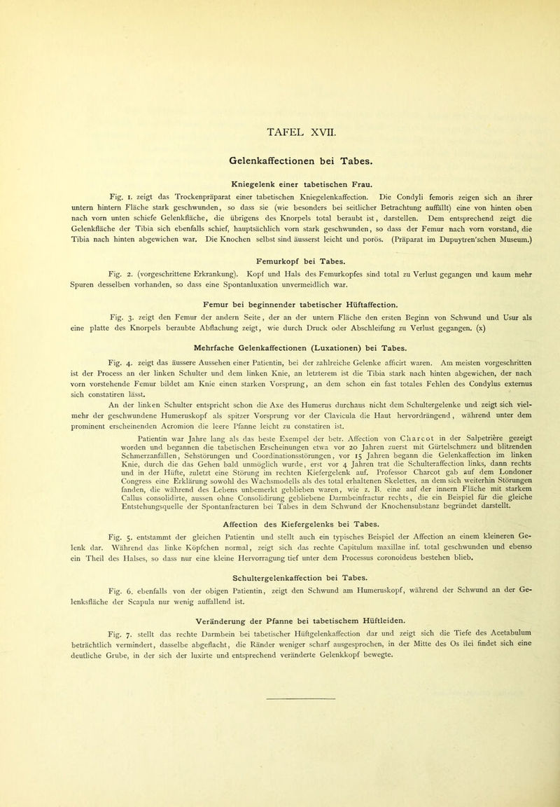 Gelenkaffectionen bei Tabes. Kniegelenk einer tabetischen Frau. Fig. I. zeigt das Trockenpräparat einer tabetischen Kniegelenkaffection. Die Condyli femoris zeigen sich an ihrer untern hintern Fläche stark geschwunden, so dass sie (wie besonders bei seitlicher Betrachtung auffällt) eine von hinten oben nach vorn unten schiefe Gelenkfläche, die übrigens des Knorpels total beraubt ist, darstellen. Dem entsprechend zeigt die Gelenkfläche der Tibia sich ebenfalls schief, hauptsächlich vorn stark geschwunden, so dass der Femur nach vom Vorstand, die Tibia nach hinten abgewichen war. Die Knochen selbst sind äusserst leicht und porös. (Präparat im Dupuytren’schen Museum.) Femurkopf bei Tabes. Fig. 2. (vorgeschrittene Erkrankung). Kopf und Hals des Femurkopfes sind total zu Verlust gegangen und kaum mehr Spuren desselben vorhanden, so dass eine Spontanluxation unvermeidlich war. Femur bei beginnender tabetischer Hüftaffection. Fig. 3. zeigt den Femur der andern Seite, der an der untern Fläche den ersten Beginn von Schwund und Usur als eine platte des Knorpels beraubte Abflachung zeigt, wie durch Druck oder Abschleifung zu Verlust gegangen, (x) Mehrfache Gelenkaffectionen (Luxationen) bei Tabes. Fig. 4. zeigt das äussere Aussehen einer Patientin, bei der zahlreiche Gelenke afficirt waren. Am meisten vorgeschritten ist der Process an der linken Schulter und dem linken Knie, an letzterem ist die Tibia stark nach hinten abgewichen, der nach vorn vorstehende Femur bildet am Knie einen starken Vorsprung, an dem schon ein fast totales Fehlen des Condylus extemus sich constatiren lässt. An der linken Schulter entspricht schon die Axe des Humerus durchaus nicht dem Schultergelenke und zeigt sich viel- mehr der geschwundene Humeruskopf als spitzer Vorsprung vor der Clavicula die Haut hervordrängend, während unter dem prominent erscheinenden Acromion die leere Pfanne leicht zu constatiren ist. Patientin war Jahre lang als das beste Exempel der betr. Affection von Cliarcot in der Salpetriere gezeigt worden und begannen die tabetischen Erscheinungen etwa vor 20 Jahren zuerst mit Gürtelschmerz und blitzenden Schmerzanfällen, Sehstörungen und Coordinationsstörungen, vor 15 Jahren begann die Gelenkaffection im linken Knie, durch die das Gehen bald unmöglich wurde, erst vor 4 Jahren trat die Schulteraffection links, dann rechts und in der Hüfte, zuletzt eine Störung im rechten Kiefergelenk auf. Professor Charcot gab auf dem Londoner Congress eine Erklärung sowohl des Wachsmodells als des total erhaltenen Skelettes, an dem sich weiterhin Störungen fanden, die während des Lebens unbemerkt geblieben waren, wie z. B. eine auf der innern Fläche mit starkem Callus consolidirte, aussen ohne Consolidirung gebliebene Darmbeinfractur rechts, die ein Beispiel für die gleiche Entstehungsquelle der Spontanfracturen bei Tabes in dem Schwund der Knochensubstanz begründet darstellt. Affection des Kiefergelenks bei Tabes. Fig. 5. entstammt der gleichen Patientin und stellt auch ein typisches Beispiel der Affection an einem kleineren Ge- während das linke Köpfchen normal, zeigt sich das rechte Capitulum maxillae inf. total geschwunden und ebenso des Halses, so dass nur eine kleine Plervorragung tief unter dem Processus coronoideus bestehen blieb. Schultergelenkaffection bei Tabes. Fig. 6. ebenfalls von der obigen Patientin, zeigt den Schwund am Humeruskopf, während der Schwund an der Ge- lenksfläche der Scapula nur wenig auffallend ist. Veränderung der Pfanne bei tabetischem Hüftleiden. Fig. 7. stellt das rechte Darmbein bei tabetischer Hiiftgelenkaffection dar und zeigt sich die Tiefe des Acetabulum beträchtlich vermindert, dasselbe abgeflacht, die Ränder weniger scharf ausgesprochen, in der Mitte des Os ilei findet sich eine deutliche Grube, in der sich der luxirte und entsprechend veränderte Gelenkkopf bewegte. lenk dar. ein Theil