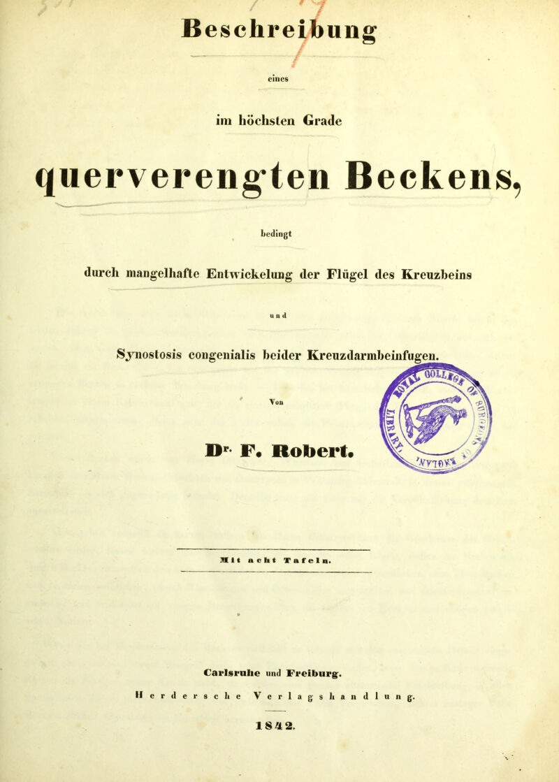 Besc im höchsten Grade querverengten Beckens, bedingt durch mangelhafte Entwickelung der Flügel des Kreuzbeins und Synostosis congenialis beider Kreuz Von Dr F. Robert. Mit acht Tafeln. Carlsruhe und Freiburg:. II erdet* sc he Verlag sh andlung. 1842.