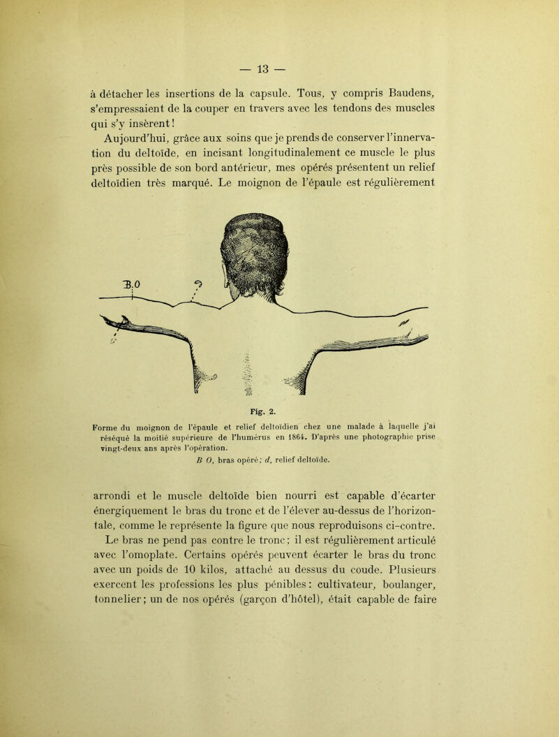 à détacher les insertions de la capsule. Tous, y compris Baudens, s’empressaient de la couper en travers avec les tendons des muscles qui s’y insèrent ! Aujourd’hui, grâce aux soins que je prends de conserver l’innerva- tion du deltoïde, en incisant longitudinalement ce muscle le plus près possible de son bord antérieur, mes opérés présentent un relief deltoïdien très marqué. Le moignon de l’épaule est régulièrement Fig. 2. Forme du moignon de l’épaule et relief deltoïdien chez une malade à laquelle j’ai réséqué la moitié supérieure de l’humérus en 1864. D’après une photographie prise vingt-deux ans après l’opération. B O, bras opéré: d, relief deltoïde. arrondi et le muscle deltoïde bien nourri est capable d’écarter énergiquement le bras du tronc et de l’élever au-dessus de l’horizon- tale, comme le représente la figure que nous reproduisons ci-contre. Le bras ne pend pas contre le tronc ; il est régulièrement articulé avec l’omoplate. Certains opérés peuvent écarter le bras du tronc avec un poids de 10 kilos, attaché au dessus du coude. Plusieurs exercent les professions les plus pénibles : cultivateur, boulanger, tonnelier ; un de nos opérés (garçon d’hôtel), était capable de faire