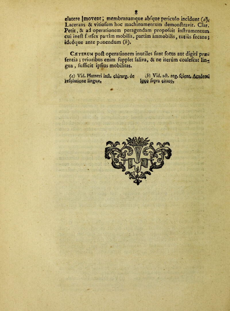 «latere |inovent; tnembranamque abfque periculo Incidunt (aji Lacerans & vitiofum hoc machinamentum demonftravit. Clar. Petit, & ad operationem peragendam propofuit inftrumentunv, cui ineft forfex partim mobilis, partim immobiKs, tutius fecansj ideoque ante ponendum (b), CETERUM poli operationem inutiles funt fotus aut digiti prae^ fentia ; prioribus enim fupplet faliva, Sc ne itenim coalefcat lin« gua , fufBcic ipiius mobilitas. (a) Vid. Hatneri inft, chirurg, de (5) Vld. ad:, reg, frient» lef^lutione lingua, lj}$Q jfuf ra «itatO}