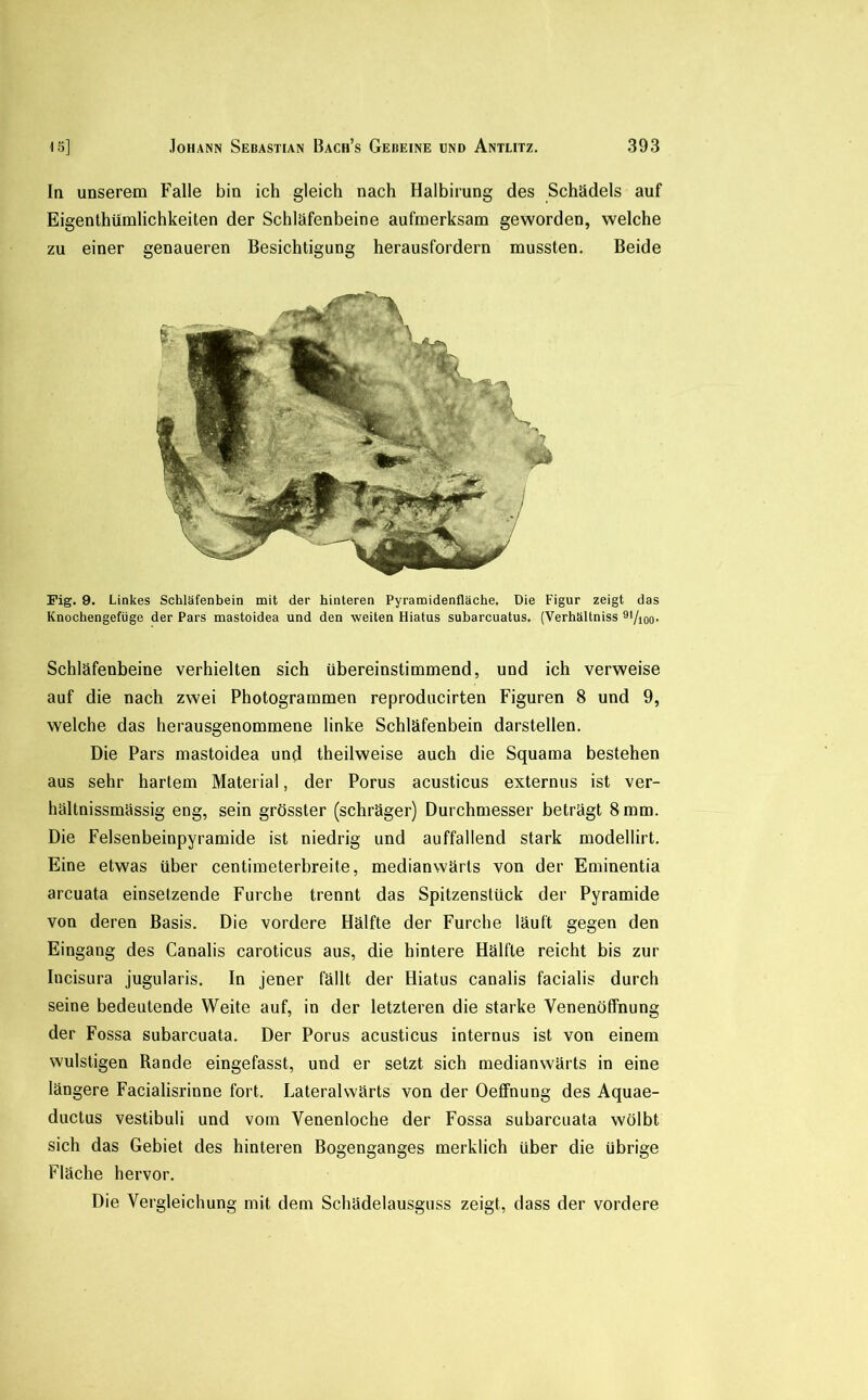 In unserem Falle bin ich gleich nach Halbirung des Schädels auf Eigenthümlichkeiten der Schläfenbeine aufmerksam geworden, welche zu einer genaueren Besichtigung herausfordern mussten. Beide Fig. 9. Linkes Schläfenbein mit der hinteren Pyramidenfläche, Die Figur zeigt das Knochengefüge der Pars mastoidea und den weiten Hiatus subarcuatus. (Verhältniss ®*/i00' Schläfenbeine verhielten sich übereinstimmend, und ich verweise auf die nach zwei Photogrammen reproducirten Figuren 8 und 9, welche das herausgenommene linke Schläfenbein darstellen. Die Pars mastoidea und theilweise auch die Squama bestehen aus sehr hartem Material, der Porus acusticus externus ist ver- hältnissmässig eng, sein grösster (schräger) Durchmesser beträgt 8 mm. Die Felsenbeinpyramide ist niedrig und auffallend stark modellirt. Eine etwas über centimeterbreite, medianwärts von der Eminentia arcuata einsetzende Furche trennt das Spitzenstück der Pyramide von deren Basis. Die vordere Hälfte der Furche läuft gegen den Eingang des Canalis caroticus aus, die hintere Hälfte reicht bis zur Incisura jugularis. In jener fällt der Hiatus canalis facialis durch seine bedeutende Weite auf, in der letzteren die starke Venenöffnung der Fossa subarcuata. Der Porus acusticus internus ist von einem wulstigen Rande eingefasst, und er setzt sich medianwärts in eine längere Facialisrinne fort. Lateralwärts von der Oeffnung des Aquae- ductus vestibuli und vom Venenloche der Fossa subarcuata wölbt sich das Gebiet des hinteren Bogenganges merklich über die übrige Fläche hervor. Die Vergleichung mit dem Schädelausguss zeigt, dass der vordere