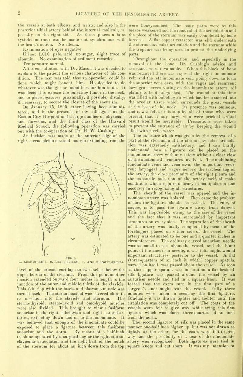 the vessels at both elbows and wrists, and also in the posterior tibial artery behind the internal malleoli, es- pecially on the right side. At these places a faint systolic murmur can be made out synchronous with the heart’s action. No edema. Examination of eyes negative. Urine: 1.016, pale, acid, no sugar, slight trace of albumin. No examination of sediment recorded. Temperature normal. After consultation with Dr. Mason it was decided to explain to the patient the serious character of his con- dition. The man was told that an operation could be done which might benefit him. He decided to do whatever was thought or found best for him to do. It was decided to expose the pulsating tumor in the neck, and to place ligatures proximally, if possible, distally, if necessary, to secure the closure of the aneurism. On January 15, 1895, ether having been adminis- tered, and in the presence of my colleagues at the Boston City Hospital and a large number of physicians and surgeons, and the third class of the Harvard Medical School, the following operation was carried out with the co-operation of Dr. Id. W. Cushing: An incision was made at the anterior edge of the right sterno-cleido-mastoid muscle extending from the level of the cricoid cartilage to two inches below the upper border of the sternum. From this point another incision extended outward four inches in length to the junction of the outer and middle thirds of the clavicle. This skin fiap with the fascia and platysma muscle was turned back. The sterno-mastoid was severed close to its insertion into the clavicle and sternum. The sterno-thyroid, sterno-hyoid and omo-hyoid muscles were also divided. This brought to view a fusiform aneurism in the right subclavian and right carotid ar- teries, extending down and on to the innominate. It was believed that enough of the innominate could be exposed to place a ligature between this fusiform aneurism and the aorta. By means of a half-inch trephine operated by a surgical engine the right sterno- clavicular articulation and the right half of the notch of the sternum for about an inch down from the top were honeycombed. The bony parts were by this means weakened and the removal of the articulation and the piece of the sternum was easily completed by bone forceps. A fiat copper retractor was slid underneath the sterno-clavicular articulation aud the 6ternum while the trephine was being used to protect the underlying parts. Throughout the operation, aud especially in the removal of the bone, Dr. Cushing’s advice and assistance were invaluable. When this block of bone was removed there was exposed the right innominate vein and the left innominate vein going down to form the superior vena cava, with the vagus and recurrent laryngeal nerves resting on the innominate artery, all plainly to be distinguished. The wound at this time was filled with bubbling air which had been sucked into the areolar tissue which surrounds the great vessels at the base of the neck. Its presence was ominous, aud it was felt at this step by all of those who were present that if any large vein were pricked a 'fatal result would be inevitable. Precautions were taken to prevent the entrance of air by keeping the wound filled with sterile water. The exposure which was given by the removal of a part of the sternum aud the sterno-clavicular articula- tion was extremely satisfactory, and I can hardly understand how a ligature can be placed on the innomiuate artery with an}7 safety without a clear view of the anatomical structures involved. The undulating innominate veins and vena cava, the important recur- rent laryngeal and vagus nerves, the tracheal tug on the artery, the close proximity of the right pleura and the expansile pulsation of the artery itself, all make conditions which require delicacy in manipulation aud accuracy in recognizing all structures. The sheath of the vessel was opened and the in- nomiuate artery was isolated. Then came the problem of how the ligatures should be passed. The rule, of course, is to pass the ligature away from danger. This was impossible, owing to the size of the vessel and the fact that it was surrounded by important structures on every side. The separation of the sheath of the artery was finally completed by means of the forefingers placed on either side of the vessel. The artery was estimated to be one and a quarter inches in circumference. The ordinary curved aneurism needle was too small to pass about the vessel, aud the blunt point of the aneurism needle, it was felt, might wound important structures posterior to the vessel. A flat (three-quarters of an inch in width) copper spatula, curved on itself, was passed about the vessel. As soon as this copper spatula was in position, a flat braided- silk ligature was passed around the vessel by an aneurism needle aud tied in a square knot. It was feared that the extra turn in the first part of a surgeon’s knot might tear the vessel. Fully three minutes were taken in securing the first ligature. Gradually it was drawn tighter and tighter until the circulation was completely cut off. The coats of the vessels were felt to give way while tying this first ligature which was placed three-quarters of an inch from the aorta. The second ligature of silk was placed in the same manner one-half iuch higher up, but was not drawn as tightly as the other, for the coats were felt to give way and the possibility of a tear of the innominate artery was recognized. Both ligatures were tied in square knots aud cut short. It was my intention to