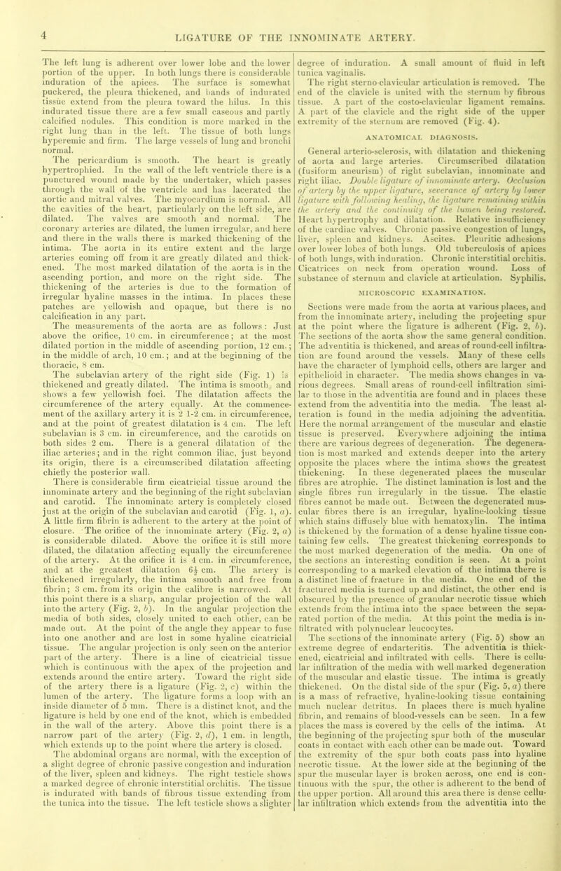 The left lung is adherent over lower lobe and the lower portion of the upper. In both lungs there is considerable induration of the apices. The surface is somewhat puckered, the pleura thickened, and bands of indurated tissue extend from the pleura toward the hilus. In this indurated tissue there are a few small caseous and partly calcified nodules. This condition is more marked in the right lung than in the left. The tissue of both lungs hyperemic and firm. The large vessels of lung and bronchi normal. The pericardium is smooth. The heart is greatly hypertrophied. In the wall of the left ventricle there is a punctured wound made by the undertaker, which passes through the wall of the ventricle and has lacerated the aortic and mitral valves. The myocardium is normal. All the cavities of the heart, particularly on the left side, are dilated. The valves are smooth and normal. The coronary arteries are dilated, the lumen irregular, and here and there in the walls there is marked thickening of the intima. The aorta in its entire extent and the large arteries coming off from it are greatly dilated and thick- ened. The most marked dilatation of the aorta is in the ascending portion, and more on the right side. The thickening of the arteries is due to the formation of irregular hyaline masses in the intima. In places these patches are yellowish and opaque, but there is no calcification in any part. The measurements of the aorta are as follows: Just above the orifice, 10 cm. in circumference; at the most dilated portion in the middle of ascending portion, 12 cm.; in the middle of arch, 10 cm.; and at the beginning of the thoracic, 8 cm. The subclavian artery of the right side (Fig. 1) is thickened and greatly dilated. The intima is smooth and shows a few yellowish foci. The dilatation affects the circumference of the artery equally. At the commence- ment of the axillary artery it is 2 1-2 cm. in circumference, and at the point of greatest dilatation is 4 cm. The left subclavian is 3 cm. in circumference, and the carotids on both sides 2 cm. There is a general dilatation of the iliac arteries; and in the right common iliac, just beyond its origin, there is a circumscribed dilatation affecting chiefly the posterior wall. There is considerable firm cicatricial tissue around the innominate artery and the beginning of the right subclavian and carotid. The innominate artery is completely closed just at the origin of the subclavian and carotid (Fig. 1, a). A little firm fibrin is adherent to the artery' at the point of closure. The orifice of the innominate artery (Fig. 2, a) is considerable dilated. Above the orifice it is still more dilated, the dilatation affecting equally' the circumference of the artery. At the orifice it is 4 cm. in circumference, and at the greatest dilatation cm. The artery is thickened irregularly, the intima smooth and free from fibrin; 3 cm. from its origin the calibre is narrowed. At this point there is a sharp, angular projection of the wall into the artery (Fig. 2, b). In the angular projection the media of both sides, closely united to each other, can be made out. At the point of the angle they appear to fuse into one another and are lost in some hyaline cicatricial tissue. The angular projection is only seen on the anterior part of the artery. There is a line of cicatricial tissue which is continuous with the apex of the projection and extends around the entire artery. Toward the right side of the artery there is a ligature (Fig. 2, c) within the lumen of the artery. The ligature forms a loop with an inside diameter of 5 mm. There is a distinct knot, and the ligature is held by one end of the knot, which is embedded in the wall of the artery. Above this point there is a narrow part of the artery (Fig. 2, d), 1 cm. in length, which extends up to the point where the artery is closed. The abdominal organs are normal, with the exception of a slight degree of chronic passive congestion and induration of the liver, spleen and kidneys. The right testicle shows a marked degree of chronic interstitial orchitis. The tissue is indurated with bands of fibrous tissue extending from the tunica into the tissue. The left testicle shows a slighter degree of induration. A small amount of fluid in left tunica vaginalis. The right sterno clavicular articulation is removed. The end of the clavicle is united with the sternum by fibrous tissue. A part of the costo-clavicular ligament remains. A part of the clavicle and the right side of the upper extremity of the sternum are removed (Fig. 4). ANATOMICAL DIAGNOSIS. General arterio-sclerosis, with dilatation and thickening of aorta and large arteries. Circumscribed dilatation (fusiform aneurism) of right subclavian, innominate and right iliac. Double ligature of innominate artery. Occlusion of artery by the upper ligature, severance of artery by lower ligature with following healing, the ligature remaining within the artery and the continuity of the lumen being restored. Heart hypertrophy and dilatation. Relative insufficiency of the cardiac valves. Chronic passive congestion of lungs, liver, spleen and kidneys. Ascites. Pleuritic adhesions over lower lobes of both lungs. Old tuberculosis of apices of both lungs, with induration. Chronic interstitial orchitis. Cicatrices on neck from operation wound. Loss of substance of sternum and clavicle at articulation. Syphilis. MICROSCOPIC EXAMINATION. Sections were made from the aorta at various places, and from the innominate artery, including the projecting spur at the point where the ligature is adherent (Fig. 2, b). The sections of the aorta show the same general condition. The adventitia is thickened, and areas of round-cell infiltra- tion are found around the vessels. Many of these cells have the character of lymphoid cells, others are larger and epithelioid in character. The media shows changes in va- rious degrees. Small areas of round-cell infiltration simi- lar to those in the adventitia are found and in places these extend from the adventitia into the media. The least al- teration is found in the media adjoining the adventitia. Here the normal arrangement of the muscular and elastic tissue is preserved. Everywhere adjoining the intima there are various degrees of degeneration. The degenera- tion is most marked and extends deeper into the artery opposite the places where the intima shows the greatest thickening. In these degenerated places the muscular fibres are atrophic. The distinct lamination is lost and the single fibres run irregularly in the tissue. The elastic fibres cannot be made out. Between the degenerated mus- cular fibres there is an irregular, hyaline-looking tissue which stains diffusely blue with hematoxylin. The intima is thickened by the formation of a dense hyaline tissue con- taining few cells. The greatest thickening corresponds to the most marked degeneration of the media. On one of the sections an interesting condition is seen. At a point corresponding to a marked elevation of the intima there is a distinct line of fracture in the media. One end of the fractured media is turned up and distinct, the other end is obscured by the presence of granular necrotic tissue which extends from the intima into the space between the sepa- rated portion of the media. At this point the media is in- filtrated with polynuclear leucocytes. The sections of the innominate artery (Fig. 5) show an extreme degree of endarteritis. The adventitia is thick- ened, cicatricial and infiltrated with cells. There is cellu- lar infiltration of the media with well marked degeneration of the muscular and elastic tissue. The intima is greatly thickened. On the distal side of the spur (Fig. 5,a) there is a mass of refractive, hyaline-looking tissue containing much nuclear detritus. In places there is much hyaline fibrin, and remains of blood-vessels can be seen. In a few places the mass is covered by the cells of the intima. At the beginning of the projecting spur both of the muscular coats in contact with each other can be made out. Toward the extremity of the spur both coats pass into hyaline necrotic tissue. At the lower side at the beginning of the spur the muscular layer is broken across, one end is con- tinuous with the spur, the other is adherent to the bend of the upper portion. All around this area there is dense cellu- lar infiltration which extends from the adventitia into the