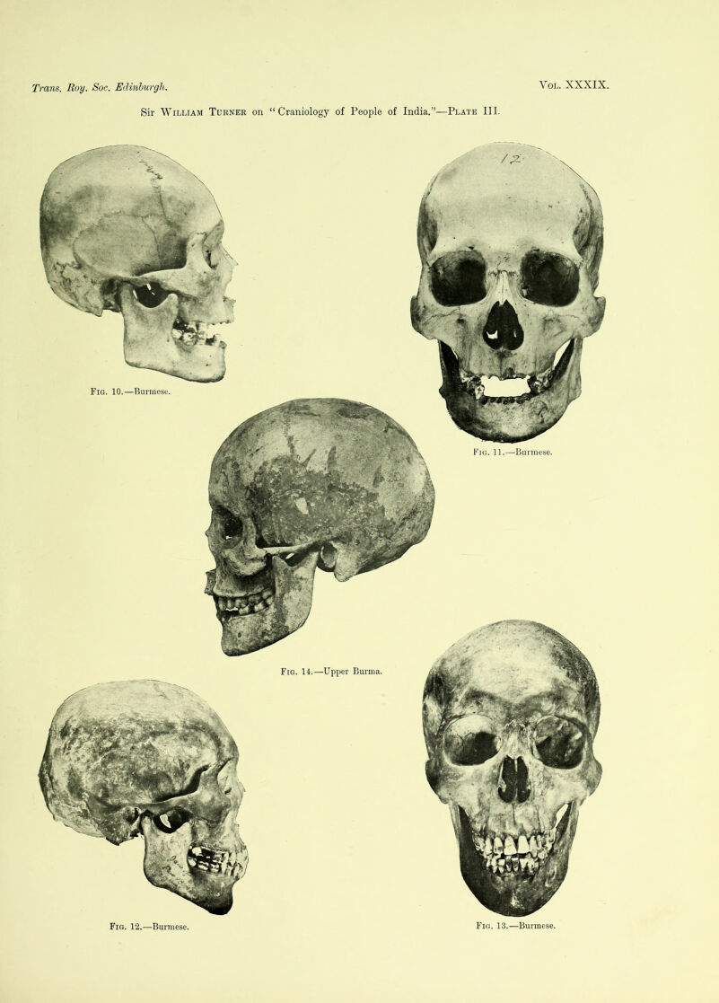 Sir William Turner on “ Craniology of People of India.”—Plate III. Fig. 14.—Upper Burma. Fig. 11.—Burmese. Fig. 10.—Burmese. Fig. 12.—Burmese. Fig. 13.—Burmese.