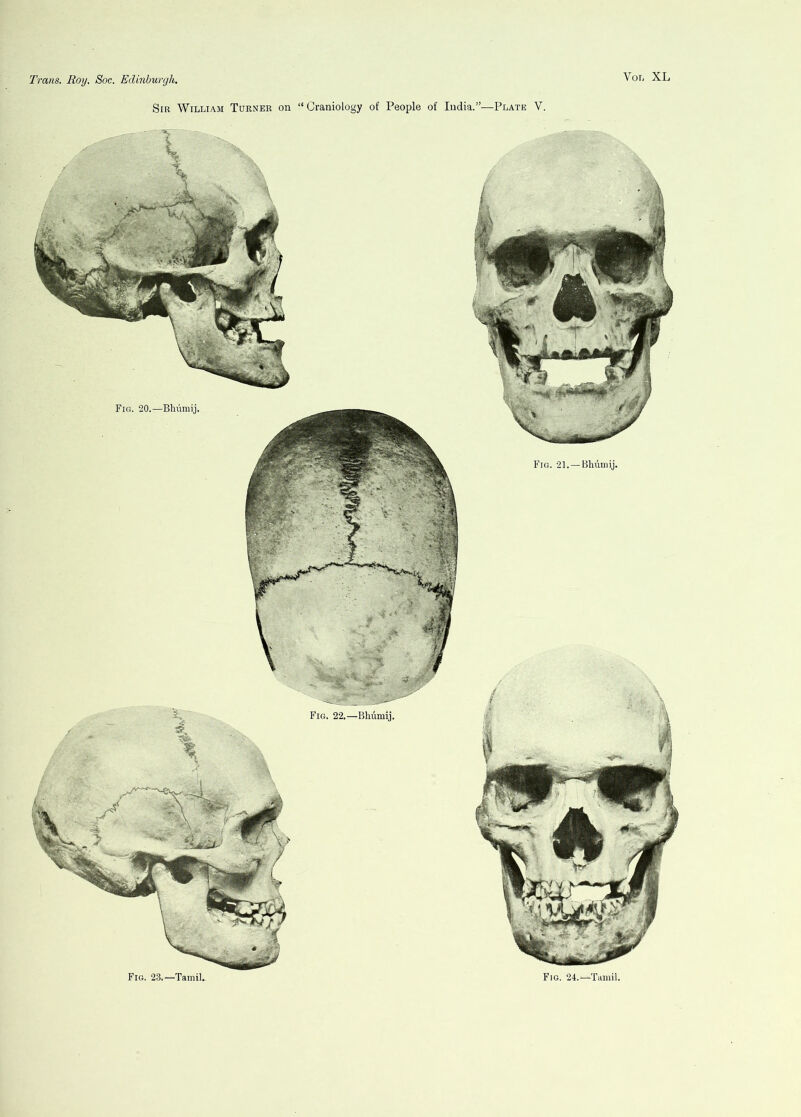 Fig. 23.—Tamil. Fig. 24.—Tamil. Sir William Turner on “Craniology of People of India.”—Plate V. Fig. 20.—Bhiimij. Fig. 2]. —Bluimij. Fig. 22.—Bliiimij.