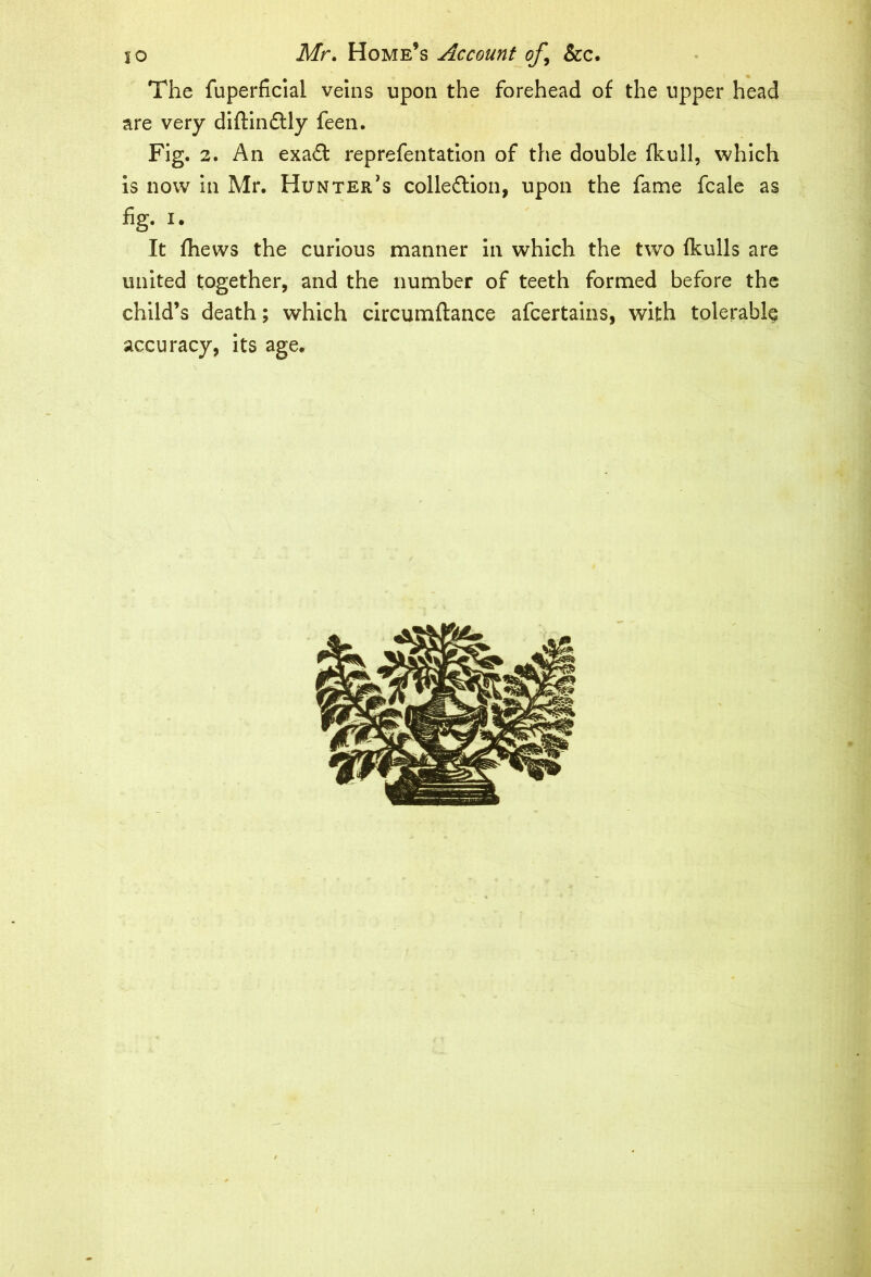 The fuperficial veins upon the forehead of the upper head are very diftindtly feen. Fig. 2. An exadc reprefentation of the double (hull, which is now in Mr. Hunter's collection, upon the fame fcale as %. i. It fhews the curious manner in which the two {hulls are united together, and the number of teeth formed before the child’s death; which circumftance afeertains, with tolerably accuracy, its age.