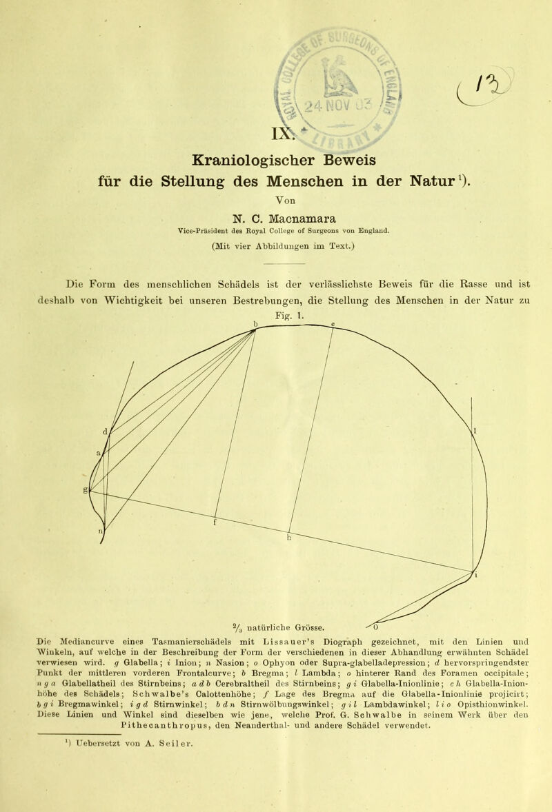 \V*\ Kr aniol ogischer Beweis für die Stellung des Menschen in der Natur1). Yon N. C. Macnamara Yice-Präsident des Royal College of Surgeons von England. (Mit vier Abbildungen im Text.) Die Form des menschlichen Schädels ist der verlässlichste Beweis für die Rasse und ist deshalb von Wichtigkeit bei unseren Bestrebungen, die Stellung des Menschen in der Natur zu Fig. 1. Die Mediancurve eines Tasmanierscbädels mit Lissauer’s Diograph gezeichnet, mit den Linien und Winkeln, auf welche in der Beschreibung der Form der verschiedenen in dieser Abhandlung erwähnten Schädel verwiesen wird, g Glabella; i Inion; n Nasion ; o Ophyon oder Supra-glabelladepression; d hervorspringendster Punkt der mittleren vorderen Frontalcurve; 6 Bregma; i Lambda; o hinterer Rand des Foramen occipitale; nga Glabellatheil des Stirnbeins; adb Cerebraltheil des Stirnbeins; gi Glabella-Inionlinie; c h Glabella-Inion- höhe des Schädels; Schwalbe’s Calottenliöhe; / Lage des Bregma auf die Glabella-Inionlinie projicirt; 6 g i Bregmawinkel; i g d Stimwinkel; b d n Stirnwölbungswinkel; g i l Lambdawinkel; l i o Opisthionwinkel. Diese Linien und Winkel sind dieselben wie jene, welche Prof. G. Schwalbe in seinem Werk über den Pithecanthropus, den Neanderthal- und andere Schädel verwendet. ') Uebersetzt von A. Seiler.