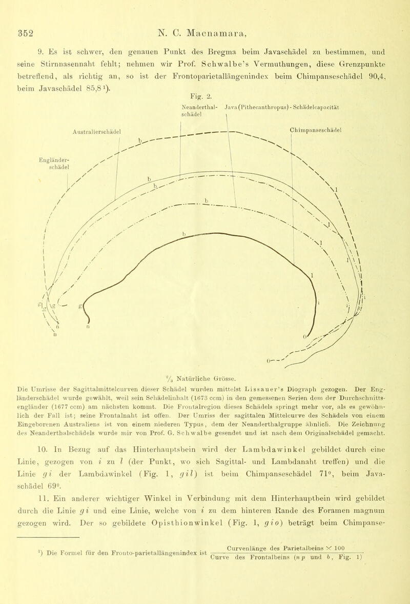 9. Es ist schwer, den genauen Punkt des Bregma beim Javaschädel zu bestimmen, und seine Stirnnasennaht fehlt; nehmen wir Prof. Schwalbe’s Vermuthungen, diese Grenzpunkte betreffend, als richtig an, so ist der Frontoparietallängenindex beim Chimpanseschädel 90,4, beim Javaschädel 85,8 x). Fig. 2. Neanderthal- Java(Pithecanthvopus) - Schädelcapacität % Natürliche Grösse. Die Umrisse der Sagittalmittelcurven dieser Schädel wurden mittelst Lissauer’s Diograph gezogen. Der Eng- länderschädel wurde gewählt, weil sein Schädelinhalt (1673 ccm) in den gemessenen Serien dem der Durchschnitts- engländer (1677 ccm) am nächsten kommt. Die Frontalregion dieses Schädels springt mehr vor, als es gewöhn- lich der Fall ist; seine Frontalnaht ist offen. Der Umriss der sagittalen Mittelcurve des Schädels von einem Eingeborenen Australiens ist von einem niederen Typus, dem der Neanderthalgruppe ähnlich. Die Zeichnung des Neanderthalschädels wurde mir von Prof. G. Schwalbe gesendet und ist nach dem Originalschädel gemacht. 10. In Bezug auf das Hinterhauptsbein wird der Lambdawinkel gebildet durch eine Linie, gezogen von i zu l (der Punkt, wo sich Sagittal- und Lambdanaht treffen) und die Linie gi der Lambdawinkel (Fig. 1, gil) ist beim Chimpanseschädel 71°, beim Java- schädel 69°. 11. Ein anderer wichtiger Winkel in Verbindung mit dem Hinterhauptbein wird gebildet durch die Linie gi und eine Linie, welche von i zu dem hinteren Rande des Foramen magnum gezogen wird. Der so gebildete Opisthionwinkel (Fig. 1, gio) beträgt beim Chimpanse- l) Die Formel für den Frouto-parietallängenindex ist Curvenlänge des Parietalbeins X 100 Curve des Frontalbeins (np und ft, Fig. 1)