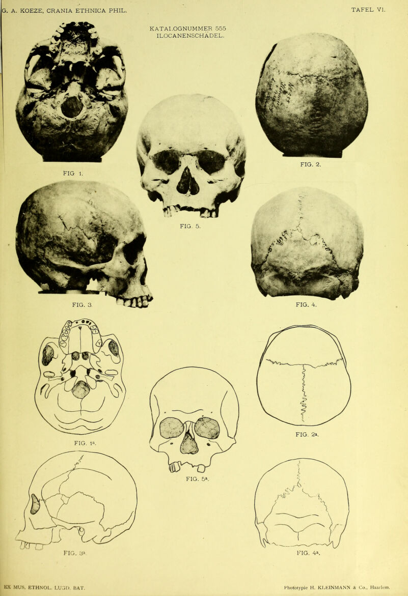 FIG. 2. FIG. 4. KATALOGNUMMER 555 ILOCANENSCHADEL.