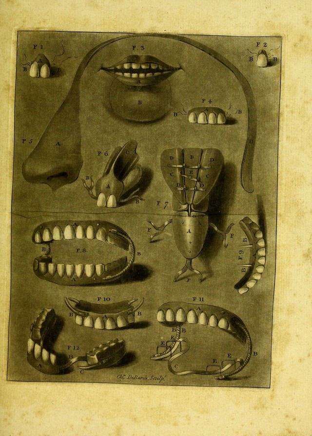 No text description is available for this image