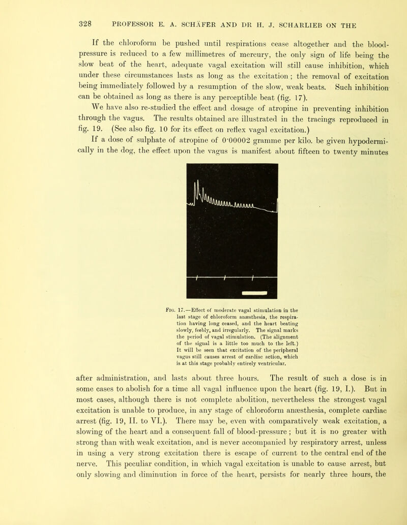 If the chloroform be pushed until respirations cease altogether and the blood- pressure is reduced to a few millimetres of mercury, the only sign of life being the slow beat of the heart, adequate vagal excitation will still cause inhibition, which under these circumstances lasts as long as the excitation; the removal of excitation being immediately followed by a resumption of the slow, weak beats. Such inhibition can be obtained as long as there is any perceptible beat (fig. 17). We have also re-studied the effect and dosage of atropine in preventing inhibition through the vagus. The results obtained are illustrated in the tracings reproduced in fig. 19. (See also fig. 10 for its effect on reflex vagal excitation.) If a dose of sulphate of atropine of 0‘00002 gramme per kilo, be given hypodermi- cally in the dog, the effect upon the vagus is manifest about fifteen to twenty minutes Fig. 17.—Effect of moderate vagal stimulation in the last stage of chloroform anaesthesia, the respira- tion having long ceased, and the heart beating slowly, feebly, and irregularly. The signal marks the period of vagal stimulation. (The alignment of the signal is a little too much to the left.) It will be seen that excitation of the peripheral vagus still causes arrest of cardiac action, which is at this stage probably entirely ventricular. after administration, and lasts about three hours. The result of such a dose is in some cases to abolish for a time all vagal influence upon the heart (fig. 19, I.). But in most cases, although there is not complete abolition, nevertheless the strongest vagal excitation is unable to produce, in any stage of chloroform anaesthesia, complete cardiac arrest (fig. 19, II. to VI.). There may be, even with comparatively weak excitation, a slowing of the heart and a consequent fall of blood-pressure ; but it is no greater with strong than with weak excitation, and is never accompanied by respiratory arrest, unless in using a very strong excitation there is escape of current to the central end of the nerve. This peculiar condition, in which vagal excitation is unable to cause arrest, but only slowing and diminution in force of the heart, persists for nearly three hours, the