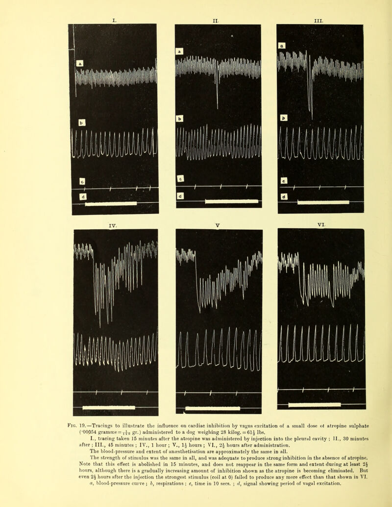 Fig. 19.—Tracings to illustrate the influence on cardiac inhibition by vagus excitation of a small dose of atropine sulphate (‘00,054 gramme = gr.) administered to a dog weighing 28 kilog. = 61J lbs. I., tracing taken 15 minutes after the atropine was administered by injection into the pleural cavity ; II., 30 minutes after ; III., 45 minutes ; IV., 1 hour ; V., 1| hours ; VI., 2J hours after administration. The blood-pressure and extent of aneesthetisation are approximately the same in all. The strength of stimulus was the same in all, and was adequate to produce strong inhibition in the absence of atropine. Note that this effect is abolished in 15 minutes, and does not reappear in the same form and extent during at least 2J hours, although there is a gradually increasing amount of inhibition shown as the atropine is becoming eliminated. But even 2£ hours after the injection the strongest stimulus (coil at 0) failed to produce any more effect than that shown in VI. a, blood-pressure curve ; b, respirations ; c, time in 10 secs. ; d, signal showing period of vagal excitation.