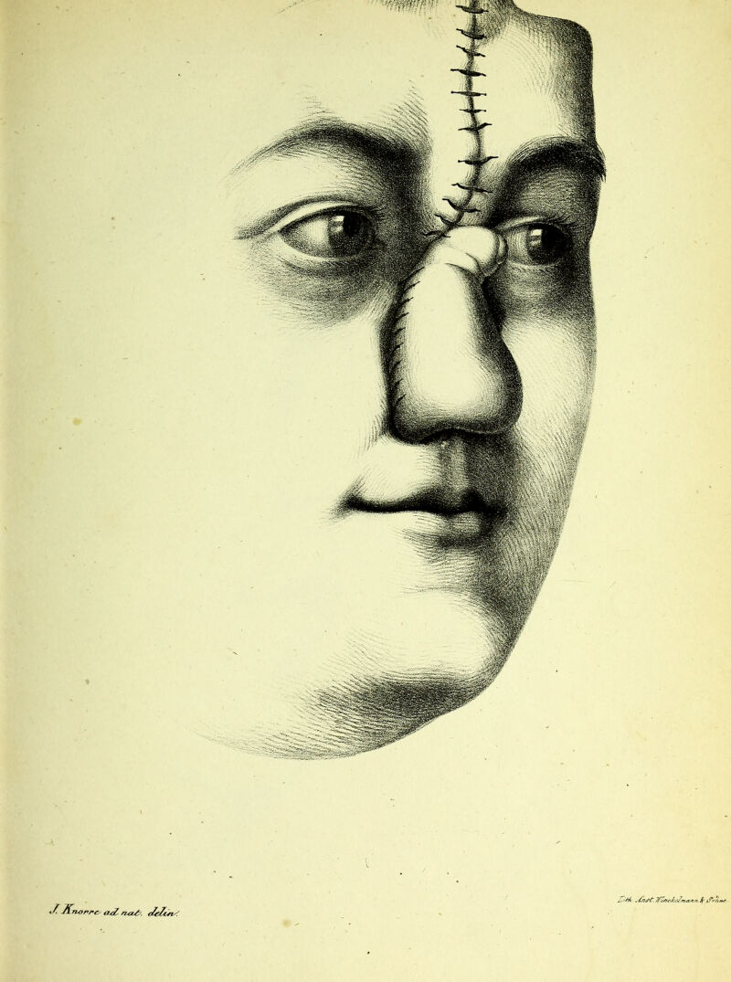 Knorr & na/?. ctgZinS TfV/JcAeJm-astn. 8f 1?VA»<-.