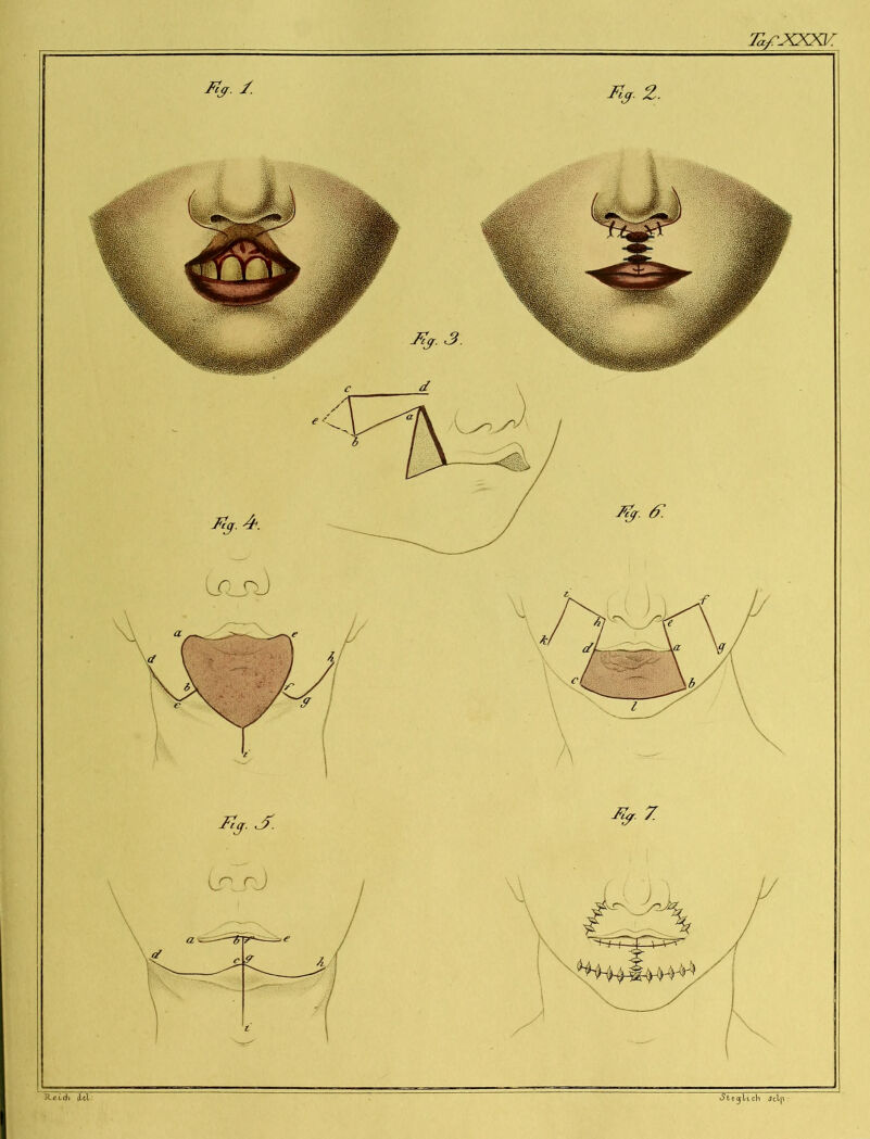 Tafxxxv: erlich Jclp Kj.2.