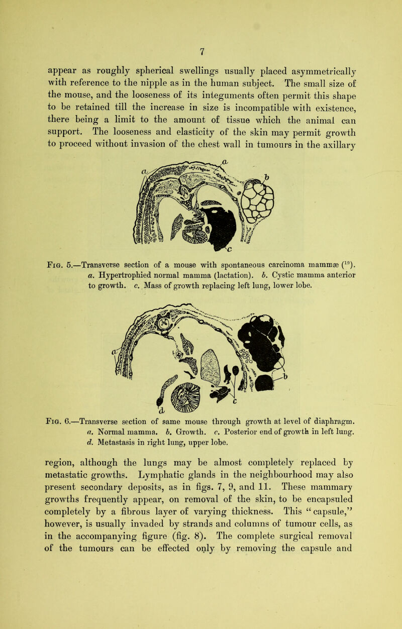 appear as roughly spherical swellings usually placed asymmetrically with reference to the nipple as in the human subject. The small size o£ the mouse, and the looseness of its integuments often permit this shape to be retained till the increase in size is incompatible with existence, there being a limit to the amount of tissue which the animal can support. The looseness and elasticity of the skin may permit growth to proceed without invasion of the chest wall in tumours in the axillary Fig. 5.—Transverse section of a mouse with spontaneous carcinoma mammse (19). a. Hypertrophied normal mamma (lactation), b. Cystic mamma anterior to growth, c. Mass of growth replacing left lung, lower lobe. Fig. 6.—Transverse section of same mouse through growth at level of diaphragm. a. Normal mamma, b. Growth, c. Posterior end of growth in left lung. d. Metastasis in right lung, upper lobe. region, although the lungs may be almost completely replaced by metastatic growths. Lymphatic glands in the neighbourhood may also present secondary deposits, as in figs. 7, 9, and 11. These mammary growths frequently appear, on removal of the skin, to be encapsuled completely by a fibrous layer of varying thickness. This “ capsule,” however, is usually invaded by strands and columns of tumour cells, as in the accompanying figure (fig. 8). The complete surgical removal of the tumours can be effected only by removing the capsule and