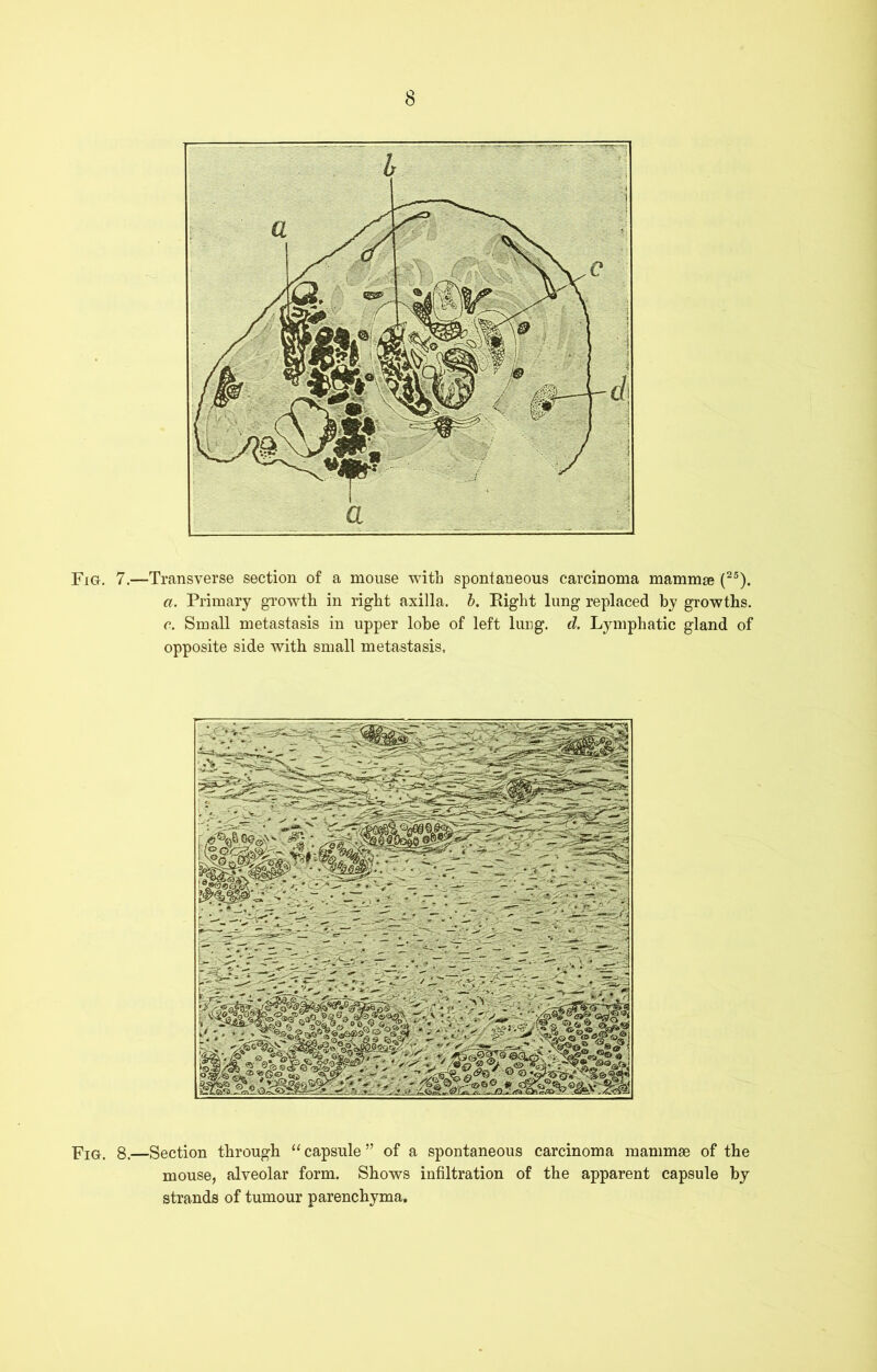 Fig. 7.—Transverse section of a mouse with spontaneous carcinoma mammae (25). a. Primary growth in right axilla, b. Eight lung replaced by growths. c. Small metastasis in upper lobe of left lung. d. Lymphatic gland of opposite side with small metastasis. PTg-. 8.—Section through “capsule” of a spontaneous carcinoma mammae of the mouse, alveolar form. Shows infiltration of the apparent capsule by strands of tumour parenchyma.