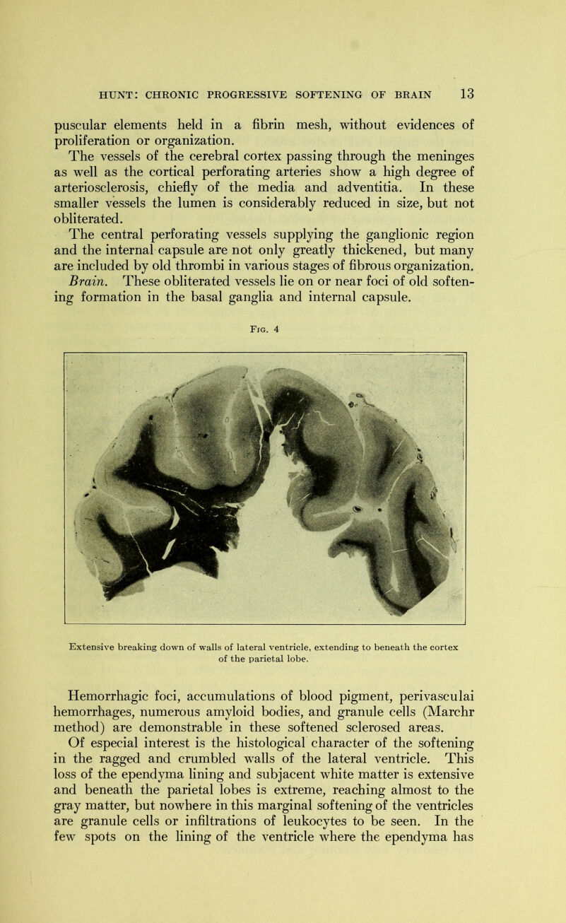 puscular elements held in a fibrin mesh, without evidences of proliferation or organization. The vessels of the cerebral cortex passing through the meninges as well as the cortical perforating arteries show a high degree of arteriosclerosis, chiefly of the media and adventitia. In these smaller vessels the lumen is considerably reduced in size, but not obliterated. The central perforating vessels supplying the ganglionic region and the internal capsule are not only greatly thickened, but many are included by old thrombi in various stages of fibrous organization. Brain. These obliterated vessels lie on or near foci of old soften- ing formation in the basal ganglia and internal capsule. Fig. 4 Extensive breaking down of walls of lateral ventricle, extending to beneath the cortex of the parietal lobe. Hemorrhagic foci, accumulations of blood pigment, perivasculai hemorrhages, numerous amyloid bodies, and granule cells (Marchr method) are demonstrable in these softened sclerosed areas. Of especial interest is the histological character of the softening in the ragged and crumbled walls of the lateral ventricle. This loss of the ependyma lining and subjacent white matter is extensive and beneath the parietal lobes is extreme, reaching almost to the gray matter, but nowhere in this marginal softening of the ventricles are granule cells or infiltrations of leukocytes to be seen. In the few spots on the lining of the ventricle where the ependyma has