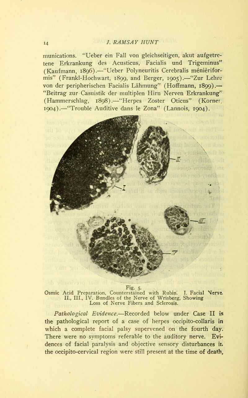 munications. “Ueber ein Fall von gleichseitigen, akut aufgetre- tene Erkrankung des Acusticus, Facialis und Trigeminus” (Kaufmann, 1896).—“Ueber Polyneuritis Cerebralis menierifor- mis” (Frankl-Hochwart, 1899, and Berger, 1905).—“Zur Lehre von der peripherischen Facialis Lahmung” (Hoffmann, 1899).— “Beitrag zur Casuistik der multiplen Hirn Nerven Erkrankung” (Hammerschlag, 1898).—“Herpes Zoster Oticus” (Korney 1904).—“Trouble Auditive dans le Zona” (Lannois, 1904). Fig. 5. Osmic Acid Preparation, Counterstained with Rubin'. I. Facial Nerve. II., III., IV. Bundles of the Nerve of Wrisberg, Showing Loss of Nerve Fibers and Sclerosis. Pathological Evidence.—Recorded below under Case II is the pathological report of a case of herpes occipito-collaris in which a complete facial palsy supervened on the fourth day. There were no symptoms referable to the auditory nerve. Evi- dences of facial paralysis and objective sensory disturbances it* the occipito-cervical region were still present at the time of death,