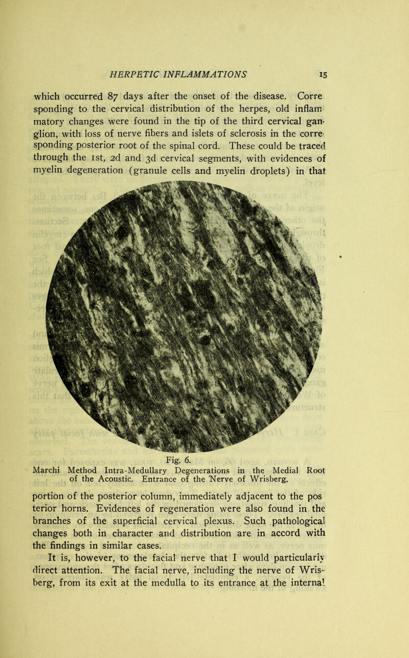 Fig. 6. Marchi Method Intra-Medullary Degenerations in the Medial Root of the Acoustic. Entrance of the Nerve of Wrisberg. portion of the posterior column, immediately adjacent to the pos terior horns. Evidences of regeneration were also found in the branches of the superficial cervical plexus. Such pathological changes both in character and distribution are in accord with the findings in similar cases. It is, however, to the facial nerve that I would particularly direct attention. The facial nerve, including the nerve of Wris- berg, from its exit at the medulla to its entrance at the interna! which occurred 87 days after the onset of the disease. Corre sponding to the cervical distribution of the herpes, old inflam matory changes were found in the tip of the third cervical gan- glion, with loss of nerve fibers and islets of sclerosis in the corre- sponding posterior root of the spinal cord. These could be traced through the 1st, 2d and 3d cervical segments, with evidences of myelin degeneration (granule cells and myelin droplets) in that