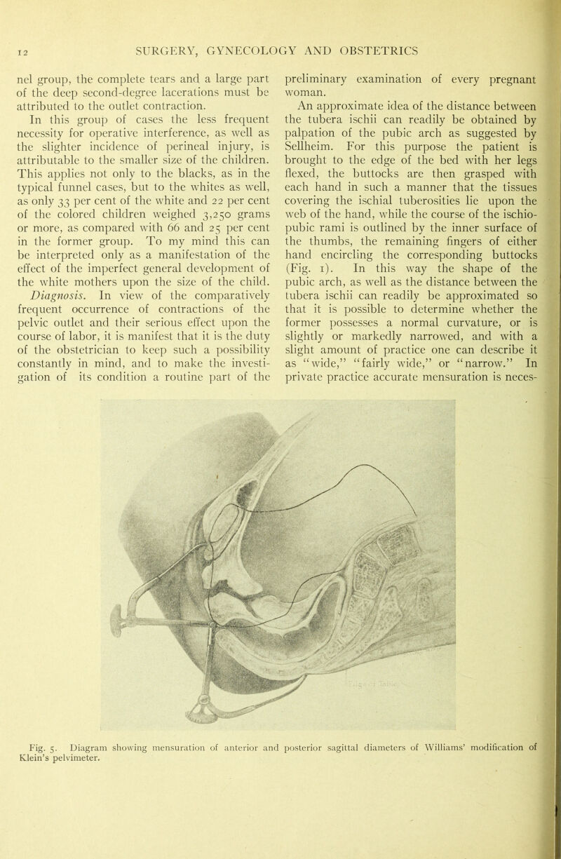 nel group, the complete tears and a large part of the deep second-degree lacerations must be attributed to the outlet contraction. In this group of cases the less frequent necessity for operative interference, as well as the slighter incidence of perineal injury, is attributable to the smaller size of the children. This applies not only to the blacks, as in the typical funnel cases, but to the whites as well, as only 33 per cent of the white and 22 per cent of the colored children weighed 3,250 grams or more, as compared with 66 and 25 per cent in the former group. To my mind this can be interpreted only as a manifestation of the effect of the imperfect general development of the white mothers upon the size of the child. Diagnosis. In view of the comparatively frequent occurrence of contractions of the pelvic outlet and their serious effect upon the course of labor, it is manifest that it is the duty of the obstetrician to keep such a possibility constantly in mind, and to make the investi- gation of its condition a routine part of the preliminary examination of every pregnant woman. An approximate idea of the distance between the tubera ischii can readily be obtained by palpation of the pubic arch as suggested by Sellheim. For this purpose the patient is brought to the edge of the bed with her legs flexed, the buttocks are then grasped with each hand in such a manner that the tissues covering the ischial tuberosities lie upon the web of the hand, while the course of the ischio- pubic rami is outlined by the inner surface of the thumbs, the remaining fingers of either hand encircling the corresponding buttocks (Fig. 1). In this way the shape of the pubic arch, as well as the distance between the tubera ischii can readily be approximated so that it is possible to determine whether the former possesses a normal curvature, or is slightly or markedly narrowed, and with a slight amount of practice one can describe it as “wide,” “fairly wide,” or “narrow.” In private practice accurate mensuration is neces- Fig. 5. Diagram showing mensuration of anterior and posterior sagittal diameters of Williams’ modification of Klein’s pelvimeter.