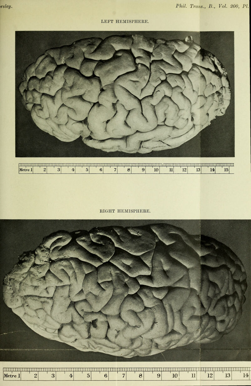 LEFT HEMISPHERE. RIGHT HEMISPHERE. Tin 1111 r 111 !l l M '111:11 11 1II INI i in in ii TinymT 1111 lu 11 u runup Tl 11 mTTTI 11111II11 TTTTTTTTT TiiiiiiiiiiiimH mi rrm 1 101 i 'ii ' 12