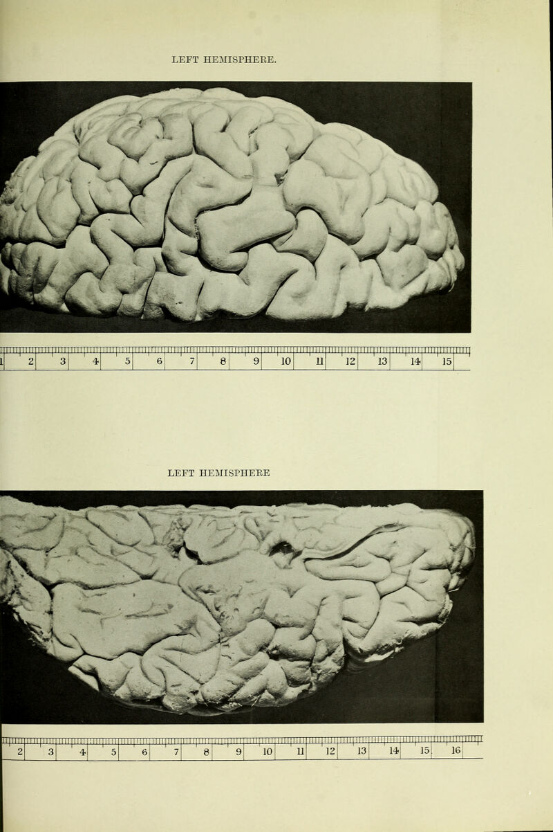 LEFT HEMISPHERE IT 1111 ! 11111111 mu rirrn 111 n it 111111! 11 11II1111 11111111TTT 111111 ITT III IIII 111 HIM II I'llll IIII1111111111! i 11111 iJJMllllJ-LIl 2 111111111 3 1111 j 1111 4 5 6 7 8 9 10 1 u t r 12 i 13! 14 15 16 1 _l _j [ I
