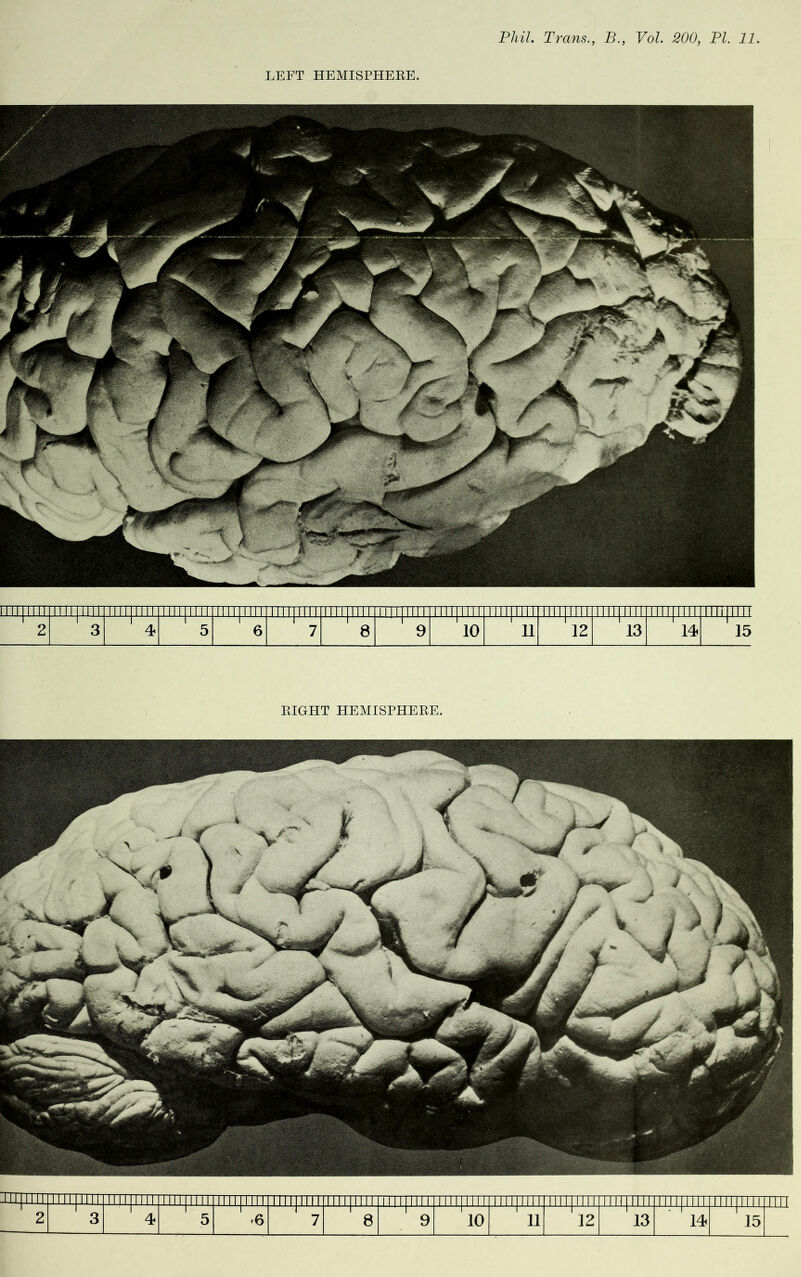 LEFT HEMISPHERE. RIGHT HEMISPHERE. min ii iuimil TNI Mil TTTTTTTTI Till |lIII 1 1 ll| III 1 II III 1! 1 Til 1 1111 IIII11111 111 l|TTTT| I II 11111 f 1ITTjTTl1 II111II11 llll|llli TTTI i i 1