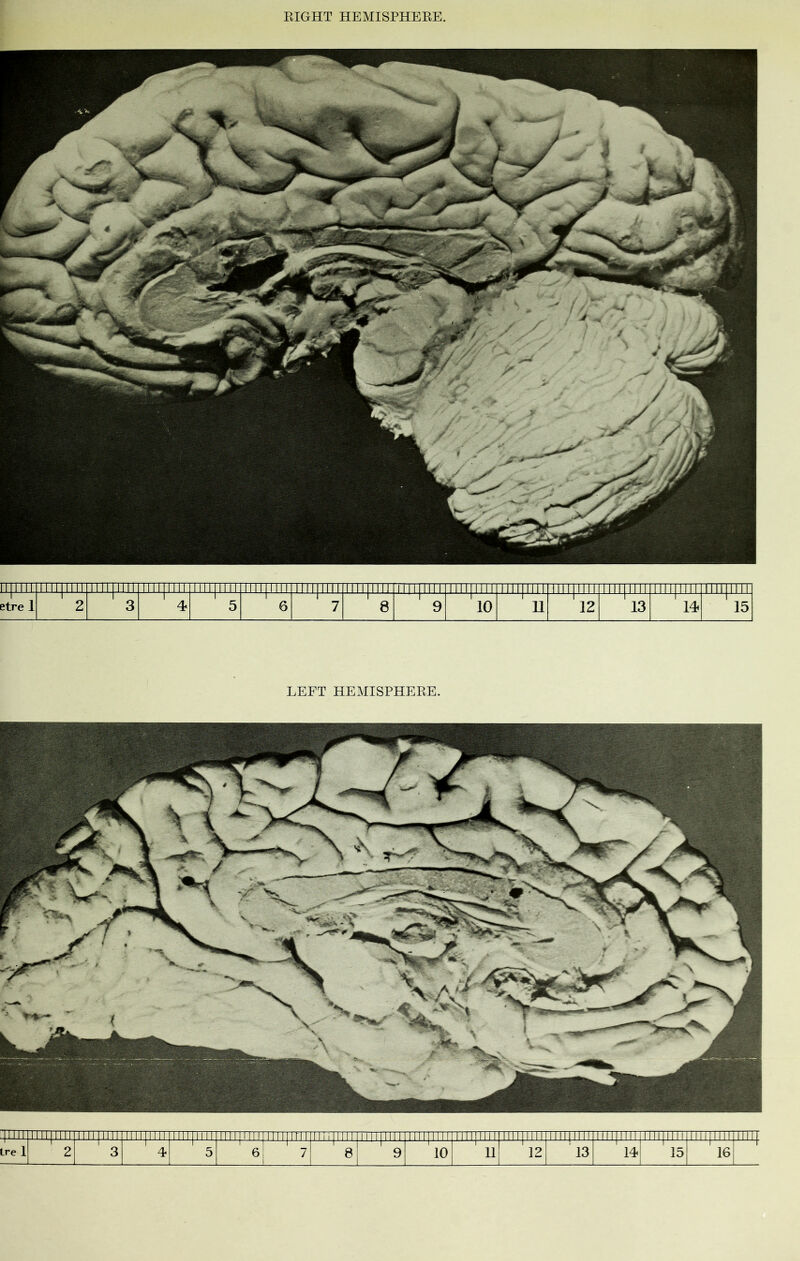 FTTTTTT irmini TTTTTTTTr lllllllll 1II11II11 lllllllll Til NTH TTTTTTTTT 'lllllllll 1 lllllllll 'in mm < 11111111 lllllllll lllllllll lllllllll l etre 1 1 2 3 4 1 5 1 6 1 7 1 8 9 10 i 11 l 12 r 13 14 1 15 LEFT HEMISPHERE. :pm TTTTjTTTl TTTTyfTTT lllllllll 111111 m 1 Tin riii im mi MmIIIM iiiiniii i i ii i |'i n r imiiiii|iiii|im lllllllll 111111111 j 111111111 llll|llll|llll| Lre 1 2 3 4 5 6 7 05 00 10 -* i 1 H 12 13 ' 14 ' 15 16 i