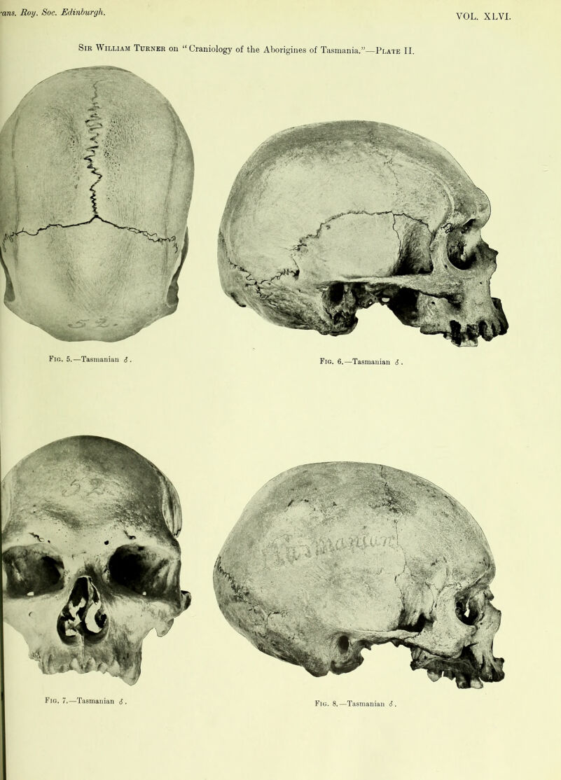 •ares. Roy. Soc. Edinburgh. VOL. XLVI. Sir V iLLiAM Turner on “ Craniology of the Aborigines of Tasmania.”—Plate II.