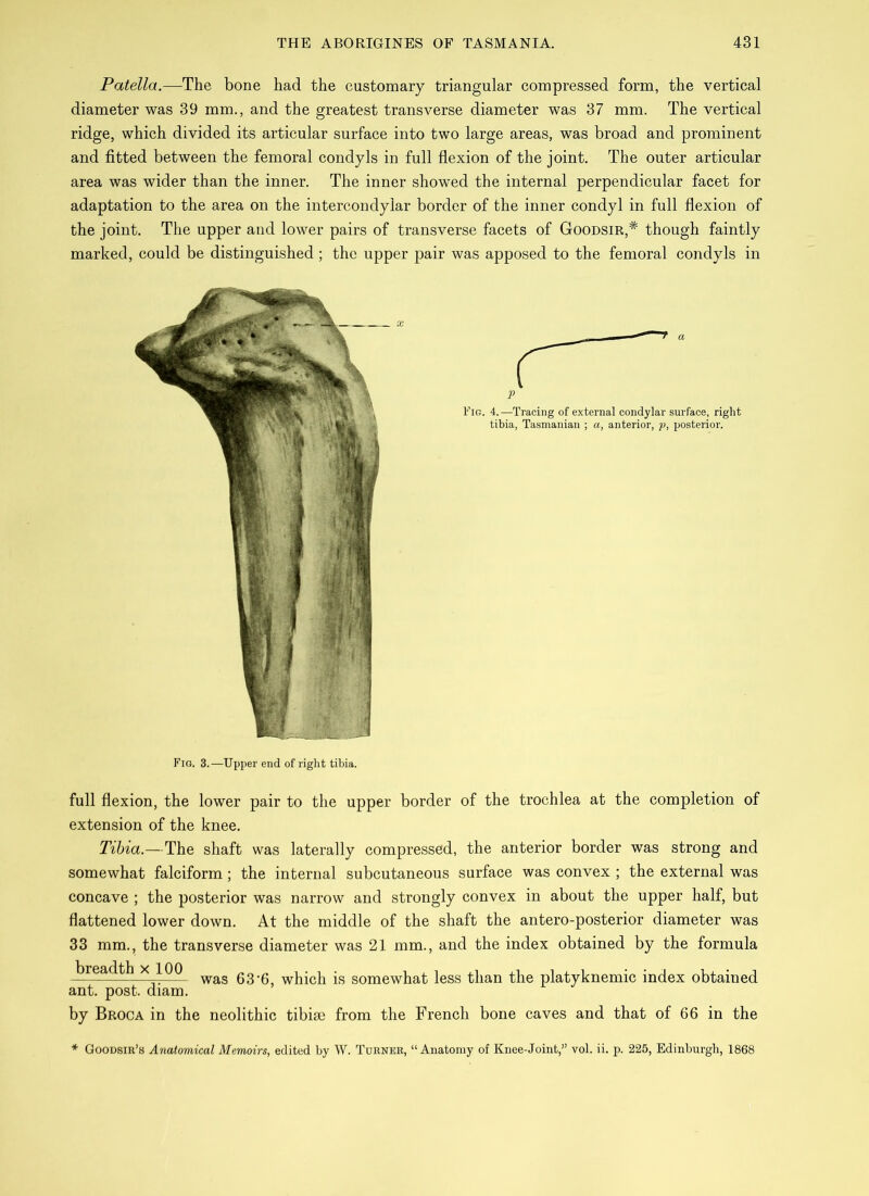 Patella.—The bone had the customary triangular compressed form, the vertical diameter was 39 mm., and the greatest transverse diameter was 37 mm. The vertical ridge, which divided its articular surface into two large areas, was broad and prominent and fitted between the femoral condyls in full flexion of the joint. The outer articular area was wider than the inner. The inner showed the internal perpendicular facet for adaptation to the area on the intercondylar border of the inner condyl in full flexion of the joint. The upper and lower pairs of transverse facets of Goodsir,# though faintly marked, could be distinguished ; the upper pair was apposed to the femoral condyls in full flexion, the lower pair to the upper border of the trochlea at the completion of extension of the knee. Tibia.— The shaft was laterally compressed, the anterior border was strong and somewhat falciform; the internal subcutaneous surface was convex ; the external was concave ; the posterior was narrow and strongly convex in about the upper half, but flattened lower down. At the middle of the shaft the antero-posterior diameter was 33 mm., the transverse diameter was 21 mm., and the index obtained by the formula —'readth x 100 was gg.0 js somewhat less than the platyknemic index obtained ant. post. diam. by Broca in the neolithic tibiae from the French bone caves and that of 66 in the Goodsir’s Anatomical Memoirs, edited by W. Turner, “Anatomy of Knee-Joint,” vol. ii. p. 225, Edinburgh, 1868