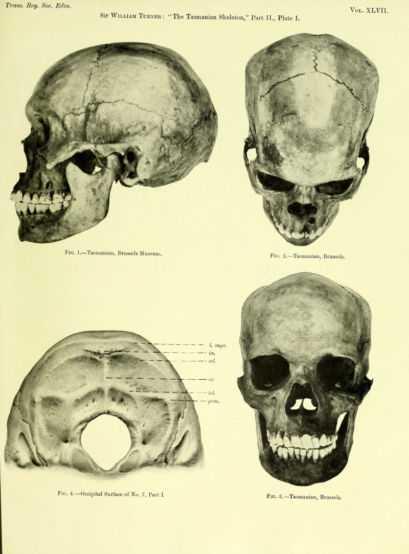Sir William Turner : “ The Tasmanian Skeleton,” Part II., Plate I. Vol. XLVI1. Fig. l.~Tasmanian, Brussels Museum. Fig. 2.—Tasmanian, Brussels. Fig. 3.—Tasmanian, Brussels.