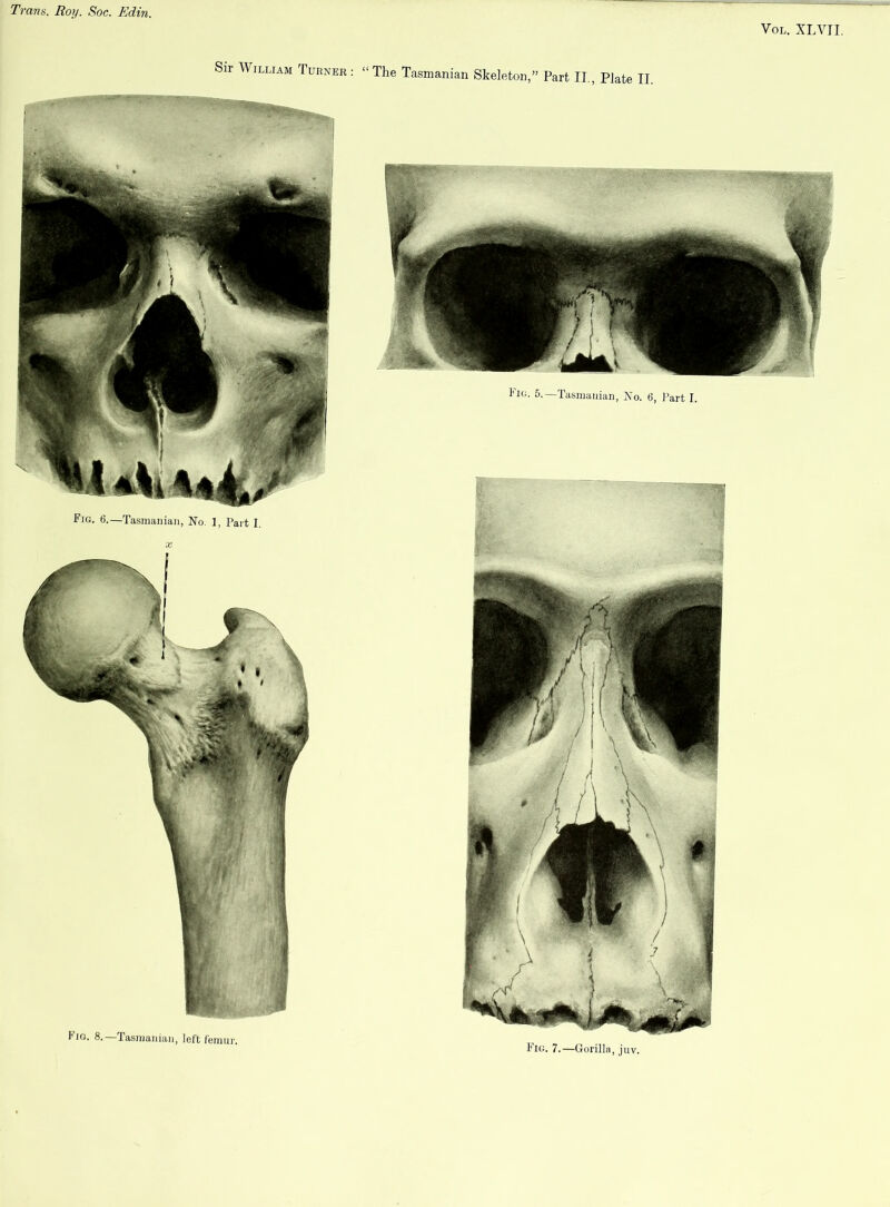 Vol. XLVII. Sir William Turner : Fig. 6.—Tasmanian, No. 1, Part I. X Fig. 8.—Tasmanian, left femur. “ The Tasmanian Skeleton,” Part II., Plate II. Fig. 5.—Tasmanian, No. 6, Part I. Fig. 7.—Gorilla, juv.