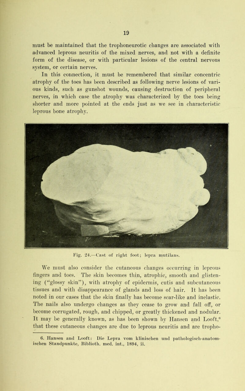 must be maintained that the trophoneurotic changes are associated with advanced leprous neuritis of the mixed nerves, and not with a definite form of the disease, or with particular lesions of the central nervous system, or certain nerves. In this connection, it must be remembered that similar concentric atrophy of the toes has been described as following nerve lesions of vari- ous kinds, such as gunshot wounds, causing destruction of peripheral nerves, in which case the atrophy was characterized by the toes being shorter and more pointed at the ends just as we see in characteristic leprous bone atrophy. Fig. 24.—Cast of right foot; lepra mutilans. We must also consider the cutaneous changes occurring in leprous fingers and toes. The skin becomes thin, atrophic, smooth and glisten- ing (“glossy skin”), with atrophy of epidermis, cutis and subcutaneous tissues and with disappearance of glands and loss of hair. It has been noted in our cases that the skin finally has become scar-like and inelastic. The nails also undergo changes as they cease to grow and fall off, or become corrugated, rough, and chipped, or greatly thickened and nodular. It may be generally known, as has been shown by Hansen and Looft,G that these cutaneous changes are due to leprous neuritis and are tropho- 6. Hansen and Looft: Die Lepra vom klinischen und pathologisch-anatom- ischen Standpunkte, Bibliotli. med. int., 1894, ii.