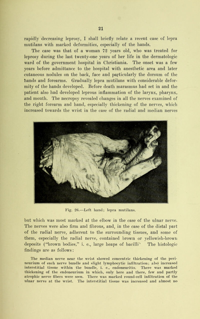 rapidly decreasing leprosy, I shall briefly relate a recent case of lepra mutilans with marked deformities, especially of the hands. The case was that of a woman 72 years old, who was treated for leprosy during the last twenty-one years of her life in the dermatologic ward of the government hospital in Christiania. The onset was a few years before admittance to the hospital with anesthetic area and later cutaneous nodules on the back, face and particularly the dorsum of the hands and forearms. Gradually lepra mutilans with considerable defor- mity of the hands developed. Before death marasmus had set in and the patient also had developed leprous inflammation of the larynx, pharynx, and mouth. The necropsy revealed changes in all the nerves examined of the right forearm and hand, especially thickening of the nerves, which increased towards the wrist in the case of the radial and median nerves Fig. 26.—Left hand; lepra mutilans. but which was most marked at the elbow in the case of the ulnar nerve. The nerves were also firm and fibrous, and, in the case of the distal part of the radial nerve, adherent to the surrounding tissues, and some of them, especially the radial nerve, contained brown or yellowish-brown deposits (“brown bodies,” i. e., large heaps of bacilliN The histologic findings are as follows: The median nerve near the wrist showed concentric thickening of the peri- neurium of each nerve bundle and slight lymphocytic infiltration; also increased interstitial tissue within the bundle, i. e., endoneuritis. There was marked thickening of the endoneurium in which, only here and there, few and partly atrophic nerve fibers were seen. There was marked round-cell infiltration of the ulnar nerve at the wrist. The interstitial tissue was increased and almost no