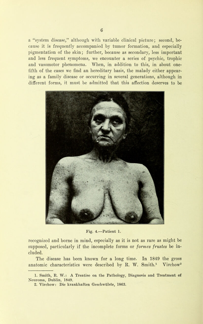 a “system disease/* although with variable clinical picture; second, be- cause it is frequently accompanied by tumor formation, and especially pigmentation of the skin: further, because as secondary, less important and less frequent symptoms, we encounter a series of psychic, trophic and vasomotor phenomena. When, in addition to this, in about one- fifth of the cases we find an hereditary basis, the malady either appear- ing as a family disease or occurring in several generations, although in different forms, it must be admitted that this affection deserves to be Fig. 4.—Patient 1. recognized and borne in mind, especially as it is not as rare as might be supposed, particularly if the incomplete forms or formes frustes be in- cluded. The disease has been known for a long time. In 1849 the gross anatomic characteristics were described by R. W. Smith.1 Virchow2 1. Smith, P. W.: A Treatise on the Pathology, Diagnosis and Treatment of Neuroma, Dublin, 1849. 2. Virchow: Die krankhaften Geschwiilste, 1863.